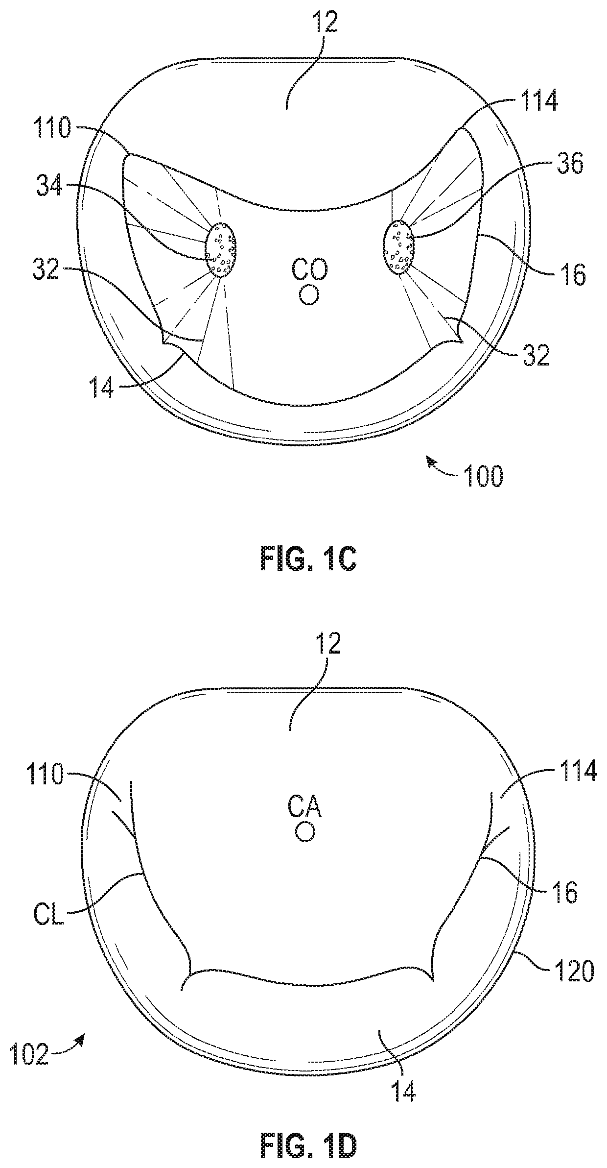 Mitral valve implants for the treatment of valvular regurgitation