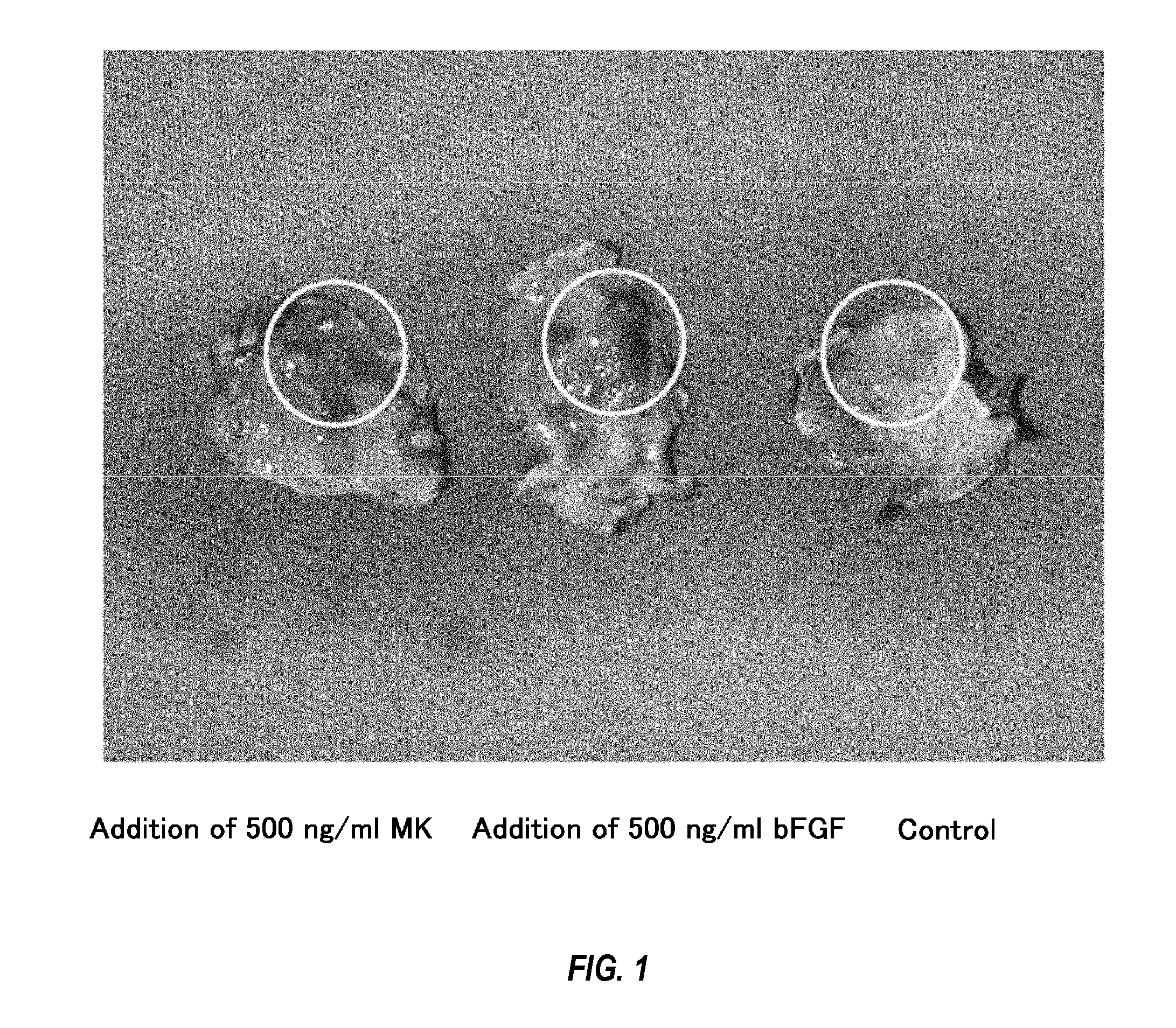 Therapeutic agent for occlusive peripheral vascular disease, and use thereof