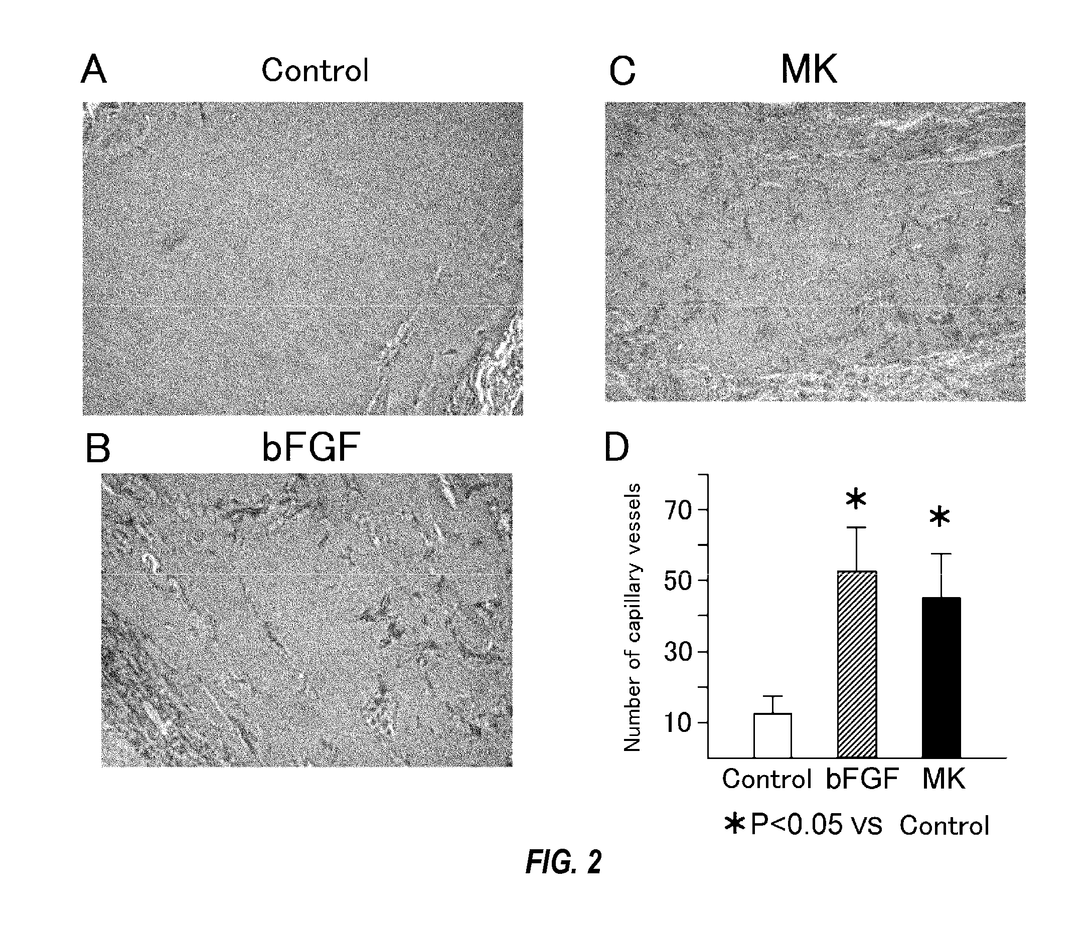 Therapeutic agent for occlusive peripheral vascular disease, and use thereof