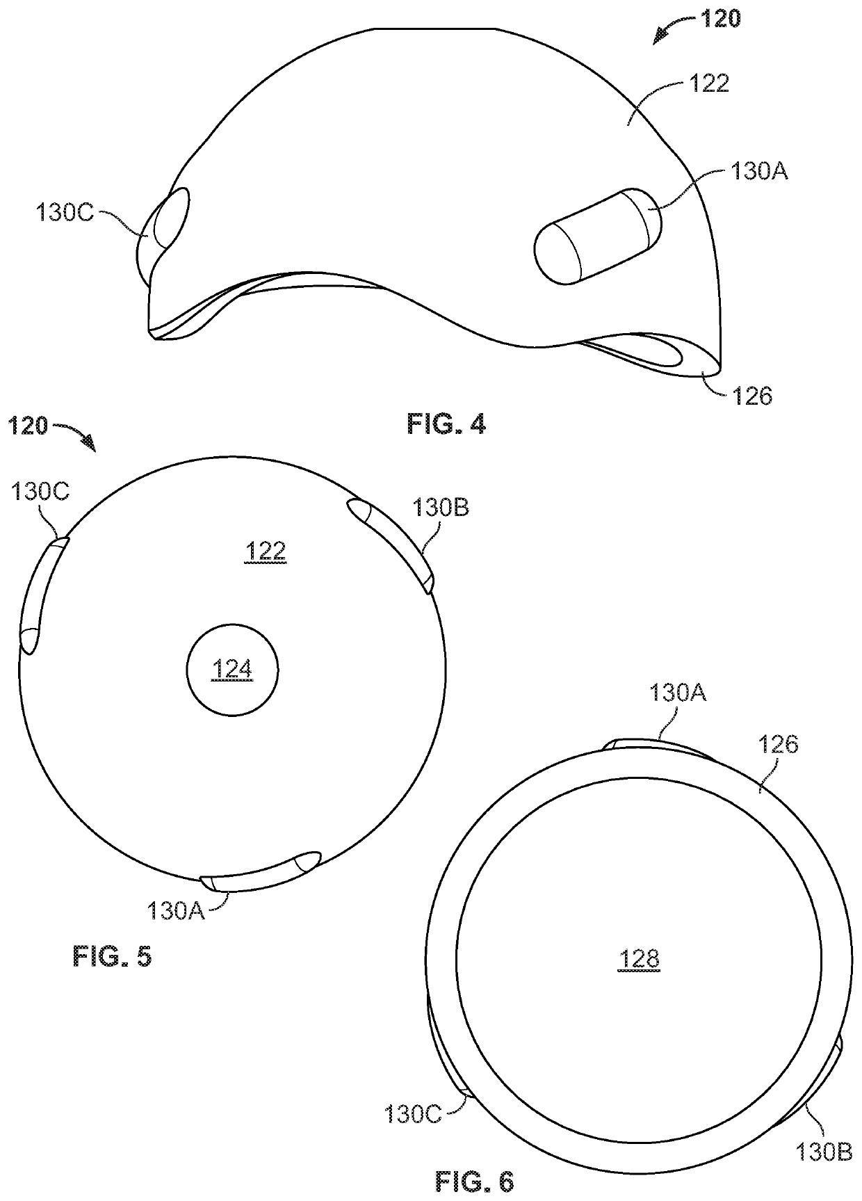 Robotic Acetabulum Preparation For Acceptance of Acetabular Cup With Engagement Features