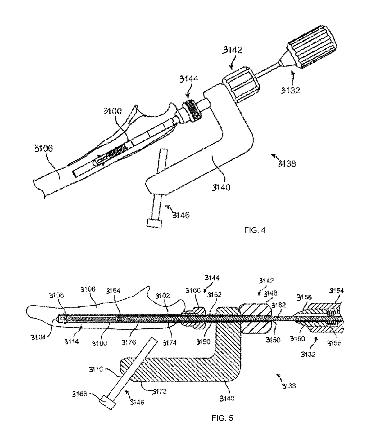 Intramedullary fracture fixation devices and methods