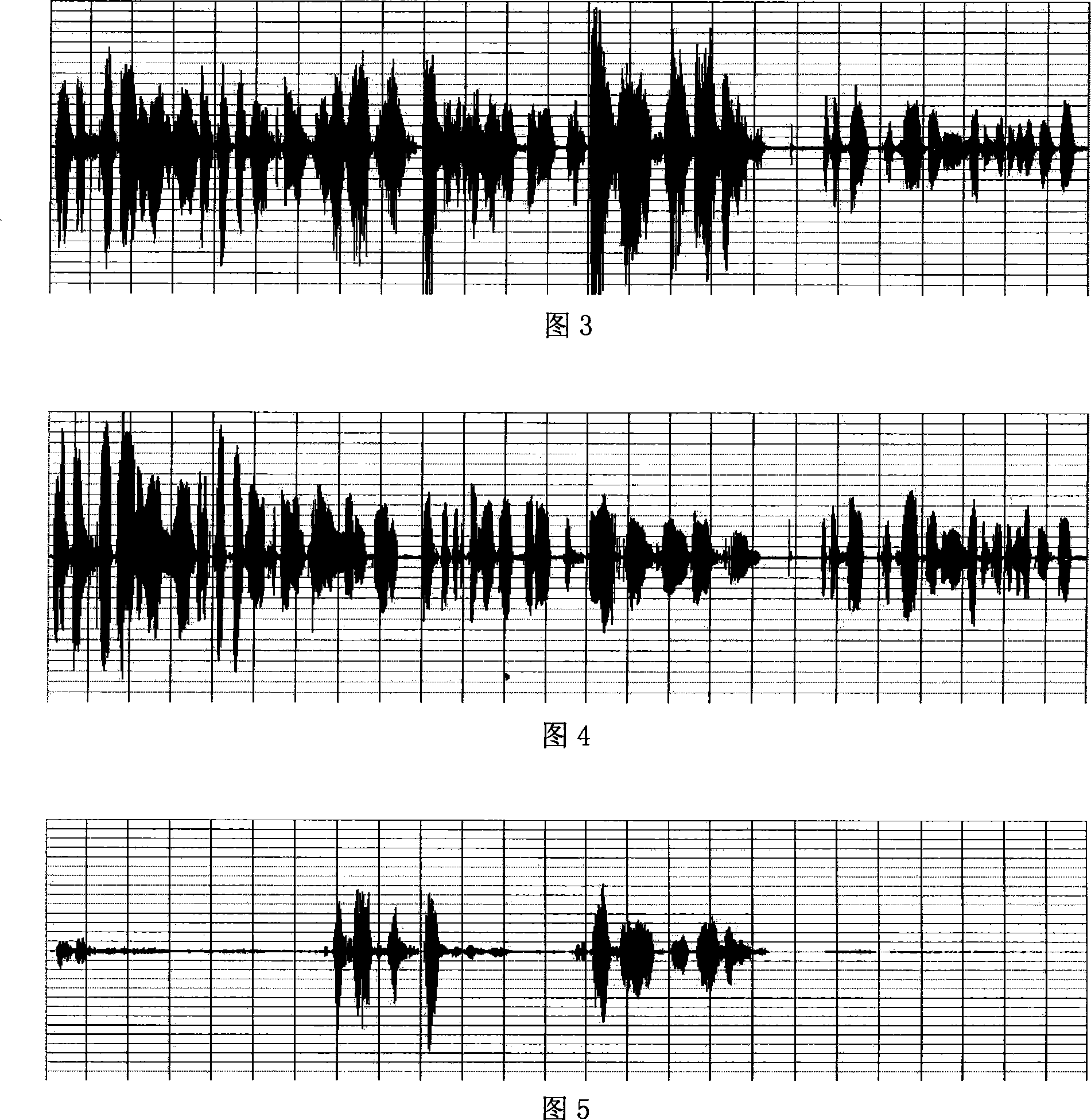 System and method for improving audio speech quality