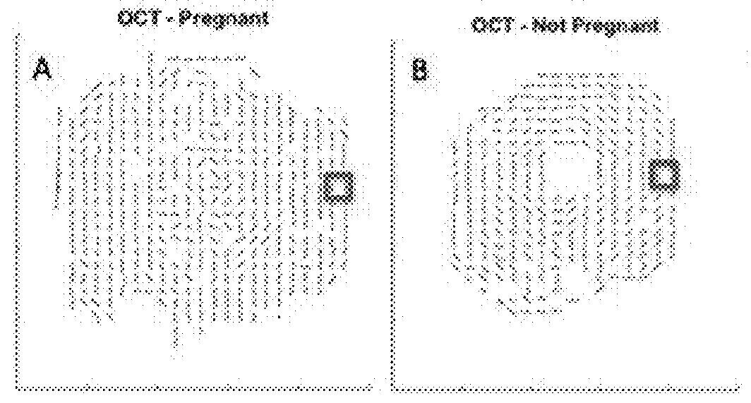 Optical imaging for preterm birth assessment