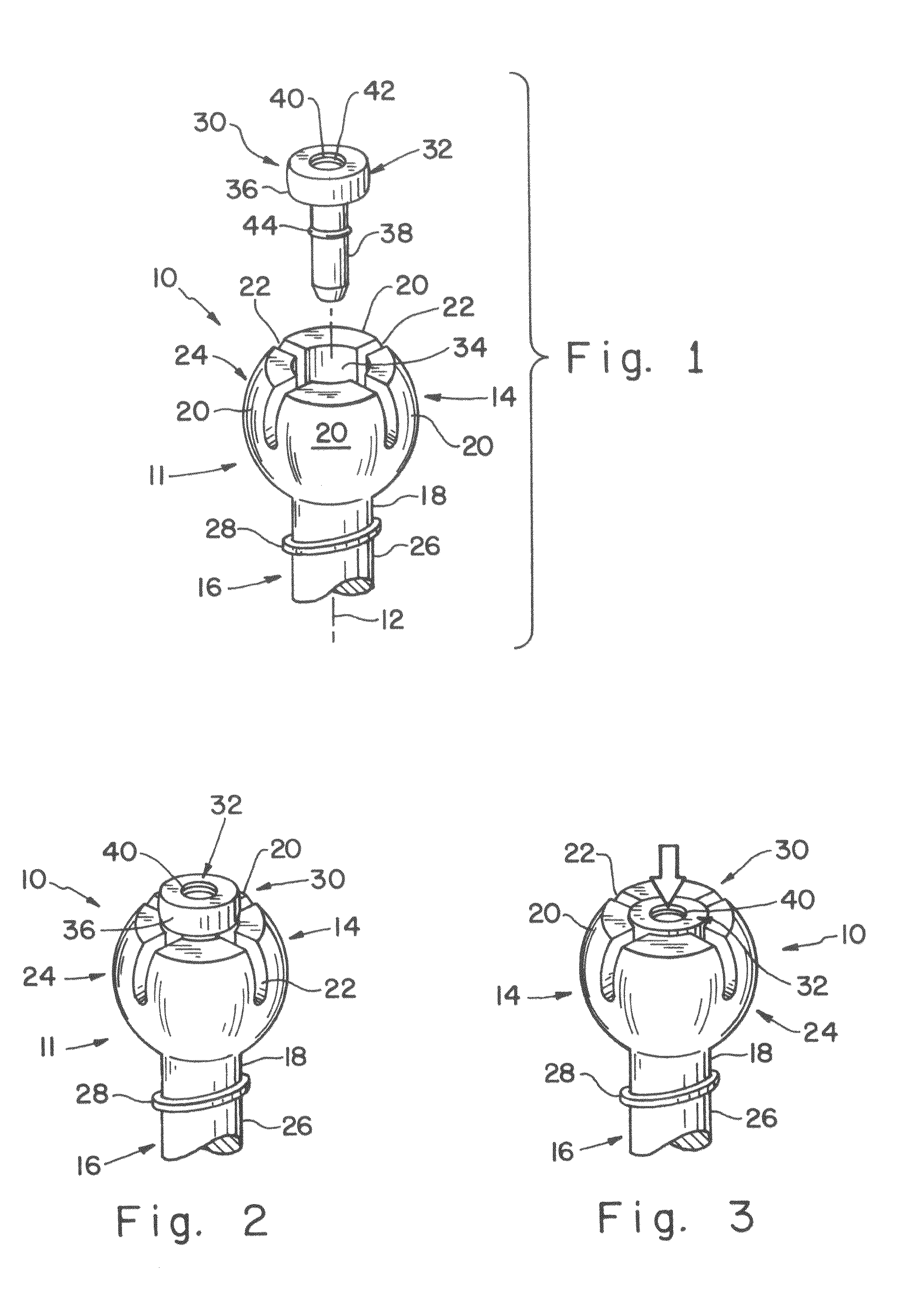 Orthopedic Anchor Assembly