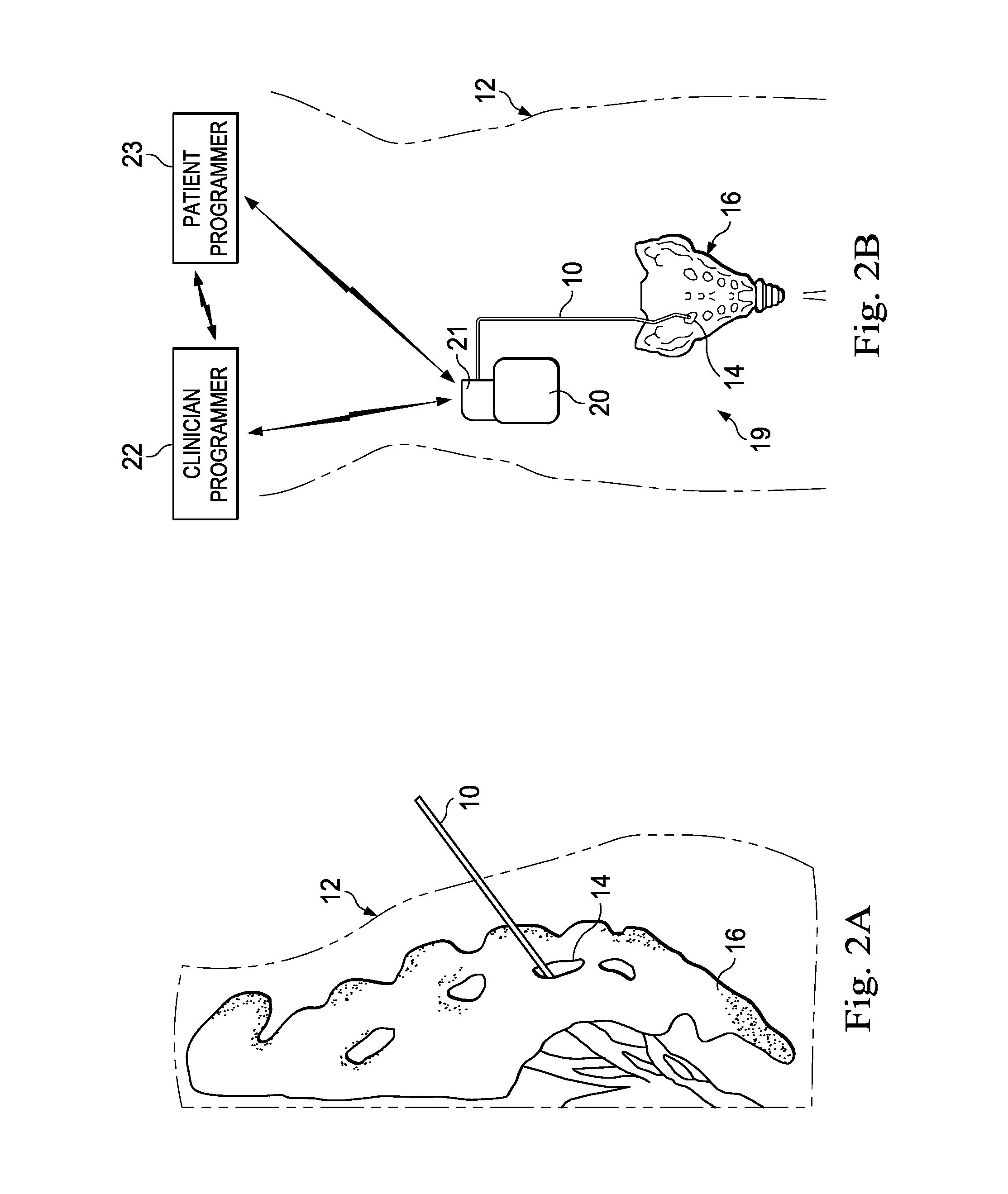 Systems, methods, and devices for generating arbitrary stimulation waveforms