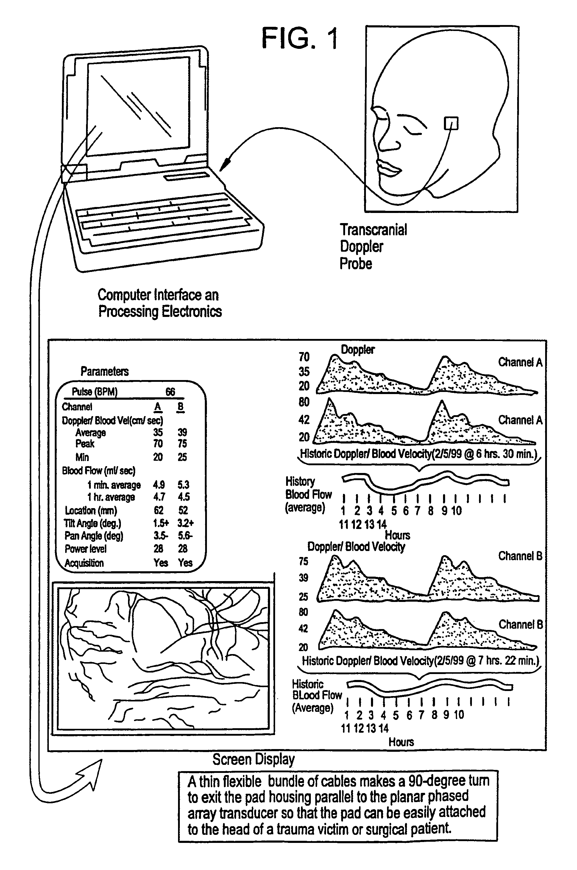 Device and method for mapping and tracking blood flow and determining parameters of blood flow