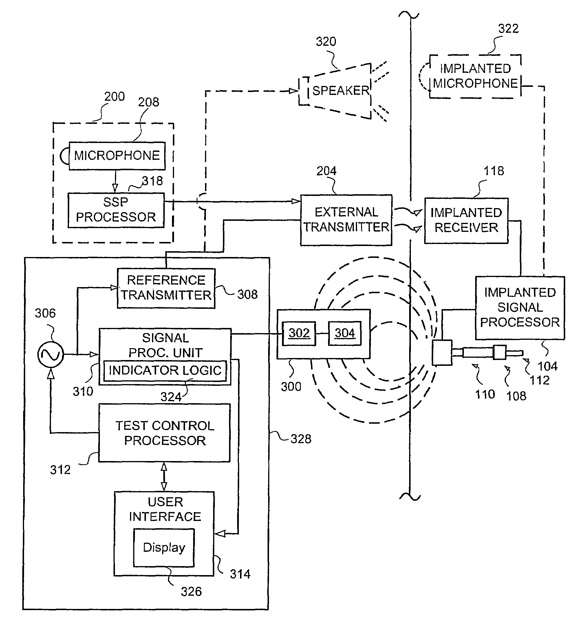 Method and system for external assessment of hearing aids that include implanted actuators