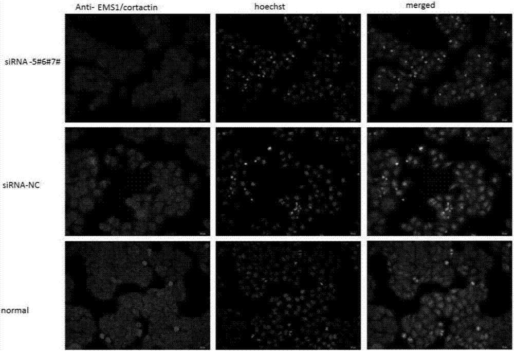 EMS1/cortactin-targeted multitarget siRNA molecule, and applications thereof