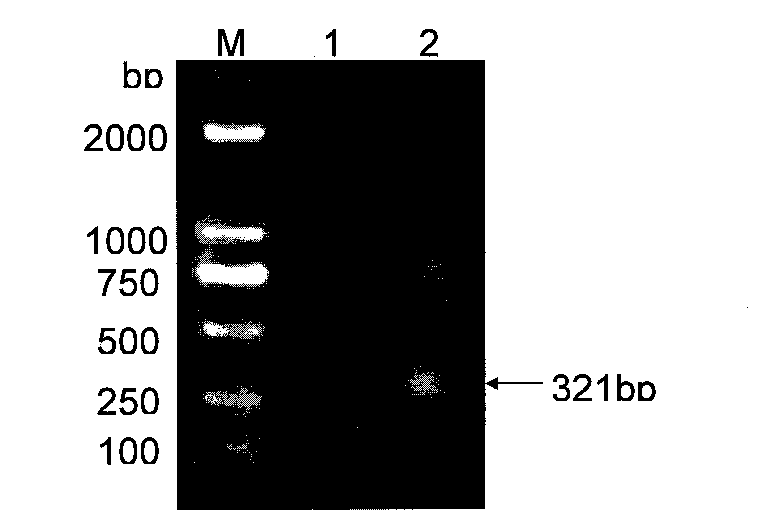 Recombinant bovine tuberculosis specific antigen protein with three fused genes and preparation method thereof