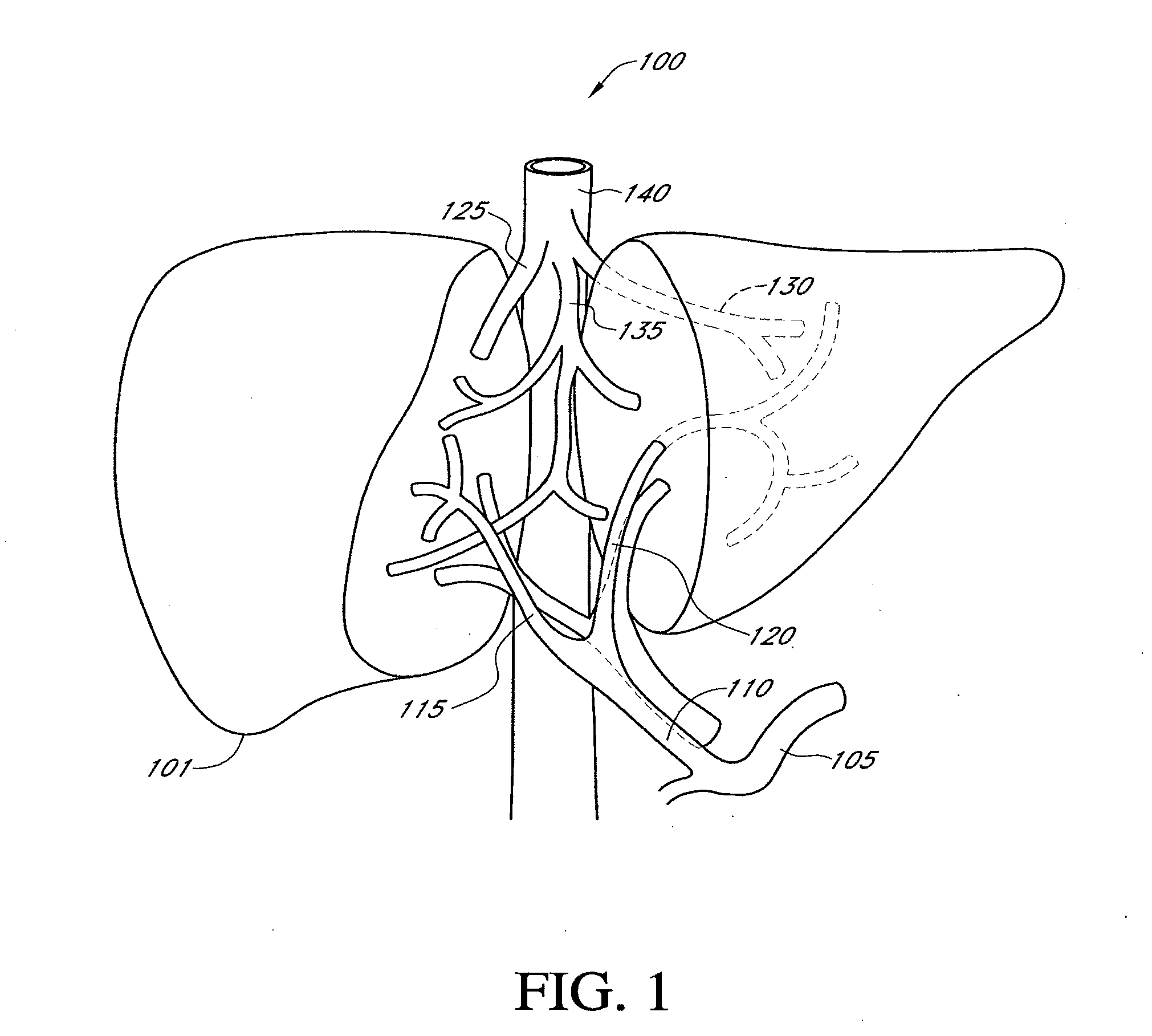 Hepatic neuromodulation using microwave energy