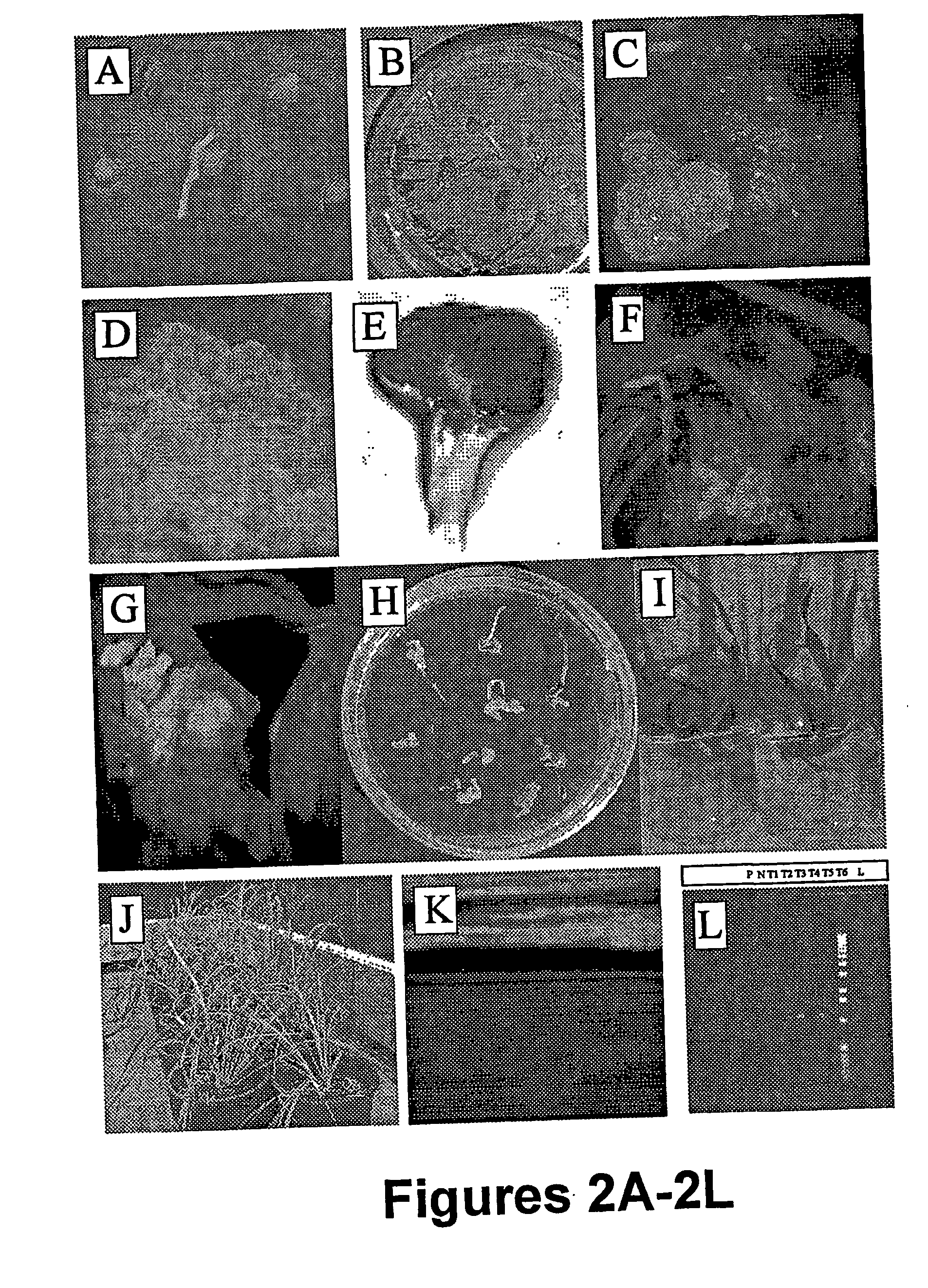 Method for transformation of mono-and di-cotyledonous plants using meristematic tissue and nodal callus from dicotyledonous plants