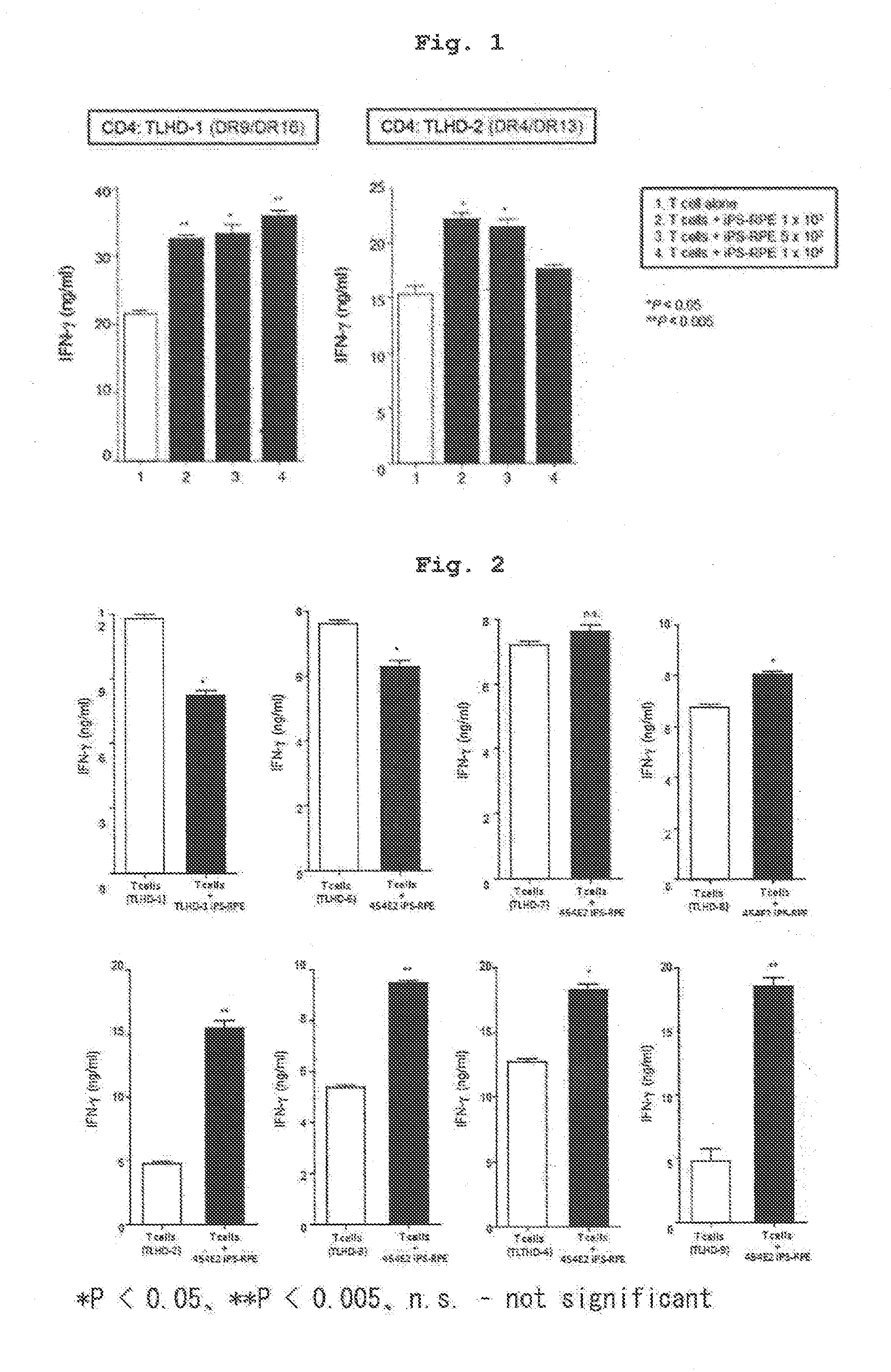 Eye disease treatment agent, screening method therefor, and method for predicting rejection response associated with retinal pigment epithelial cell transplant