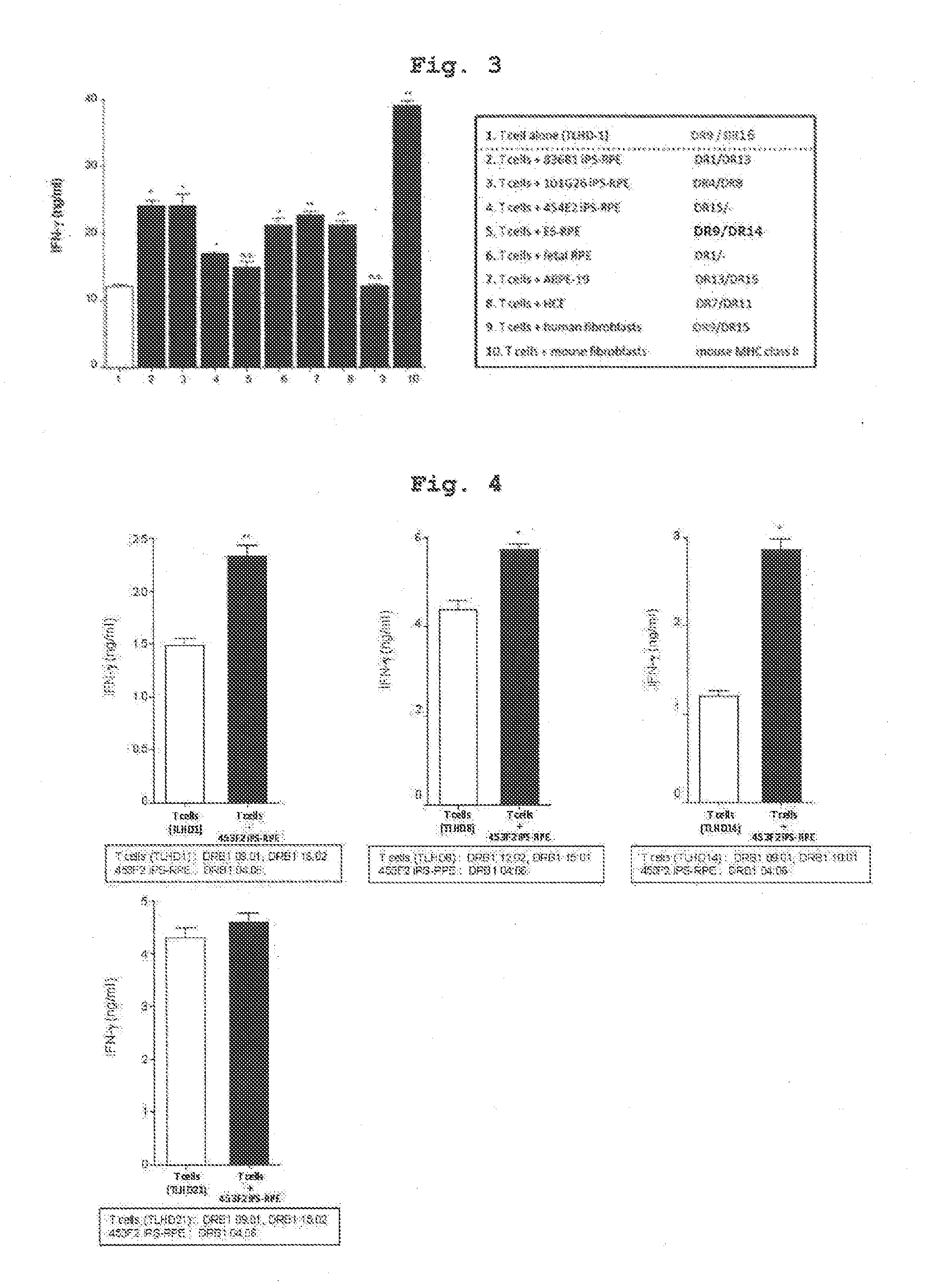 Eye disease treatment agent, screening method therefor, and method for predicting rejection response associated with retinal pigment epithelial cell transplant
