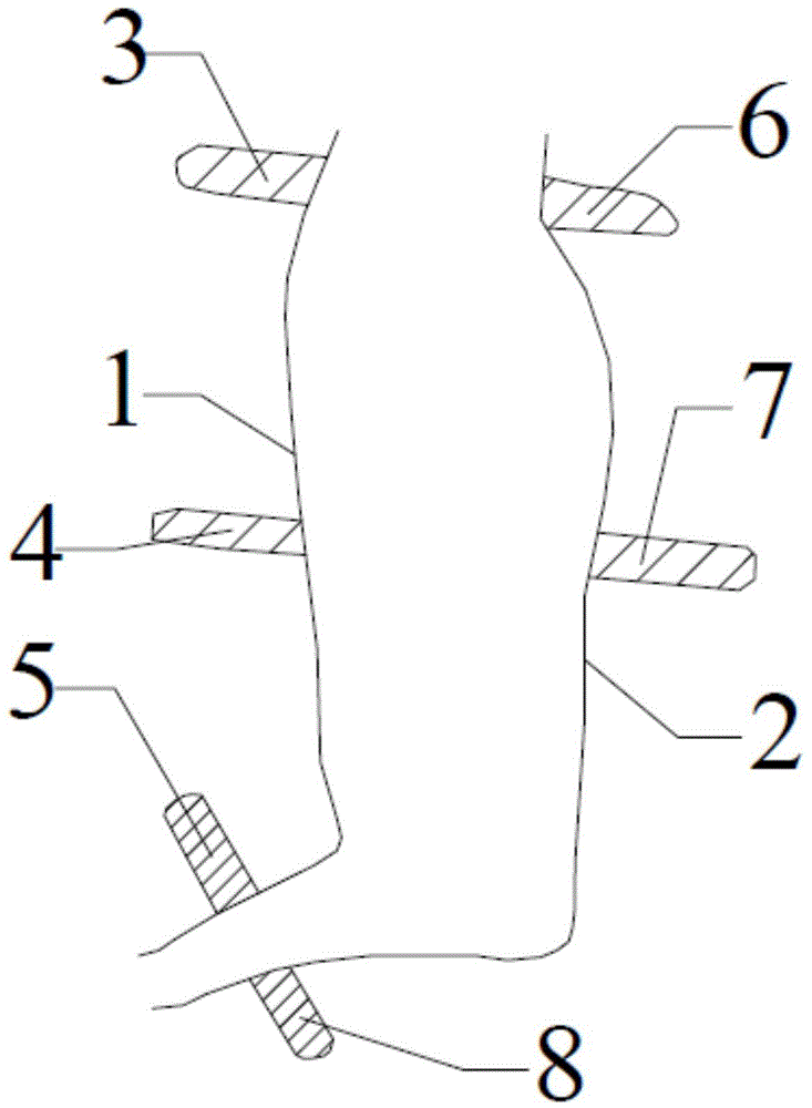 Flap postoperative protection device for lower middle segment of shank