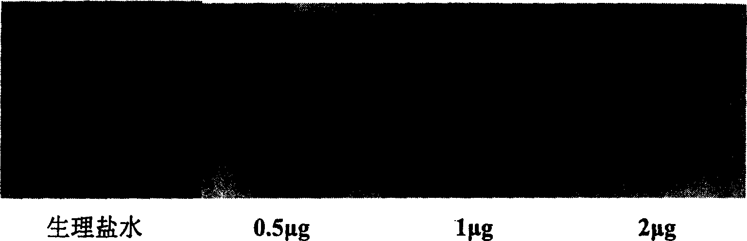 Method and use of producing soluble recombinant protein in colibacillus