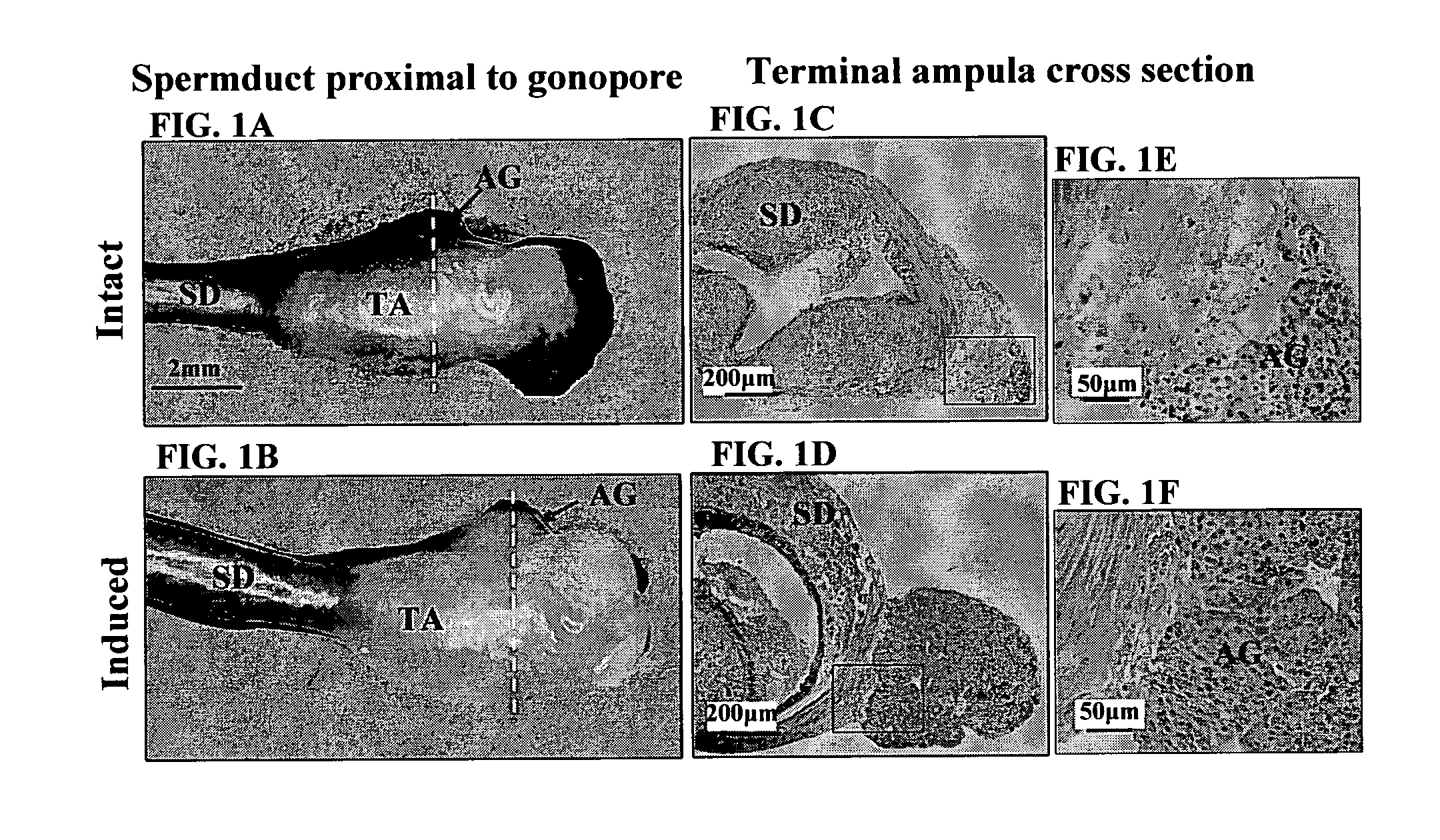 Insulin-like gene of prawns and uses thereof