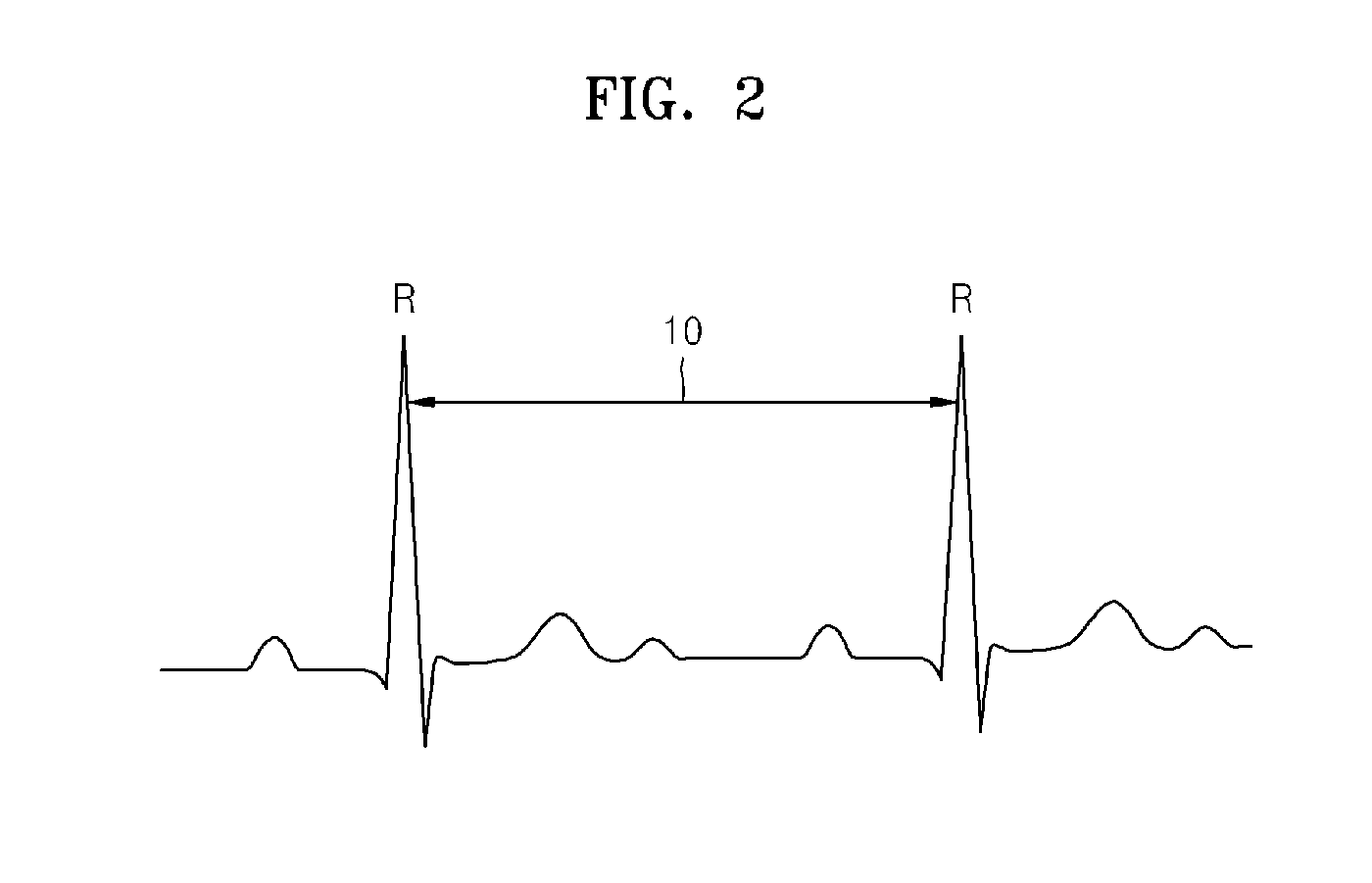 Method and apparatus for controlling load shedding in data stream management system