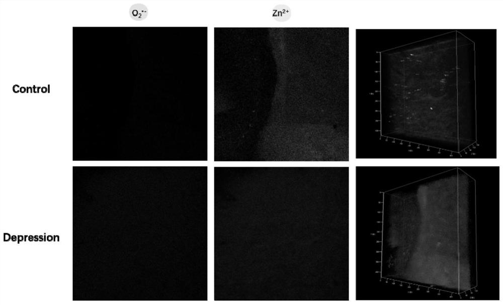 A kind of two-color fluorescent probe and its synthesis method and application