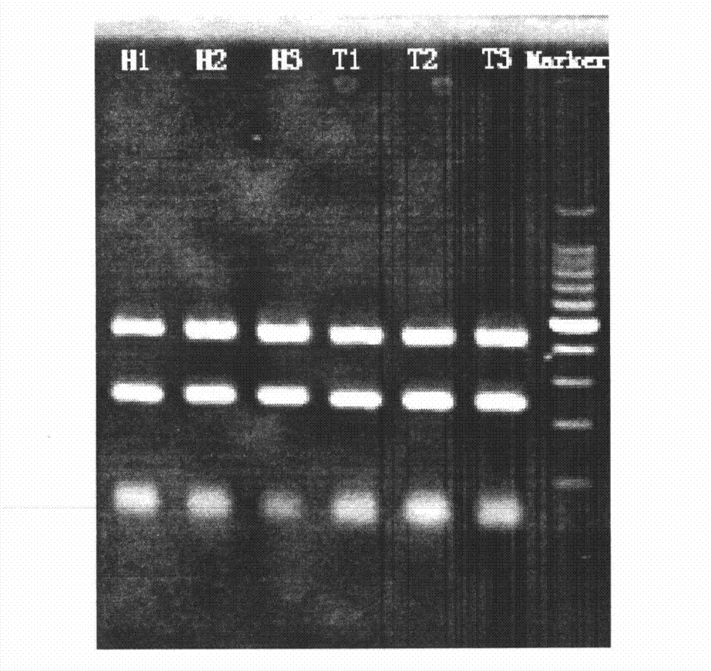 Kit for detecting genotyping and IL28-site polymorphism of hepatitis C virus (HCV)