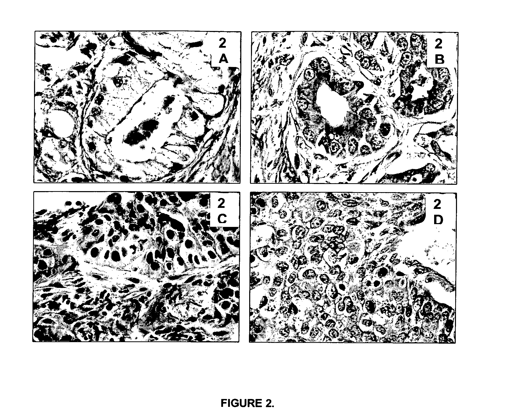 Methods, Reagents, Devices and Instrumentation For Preparing Impregnated Tissue Samples Suitable For Histopathological and Molecular Studies