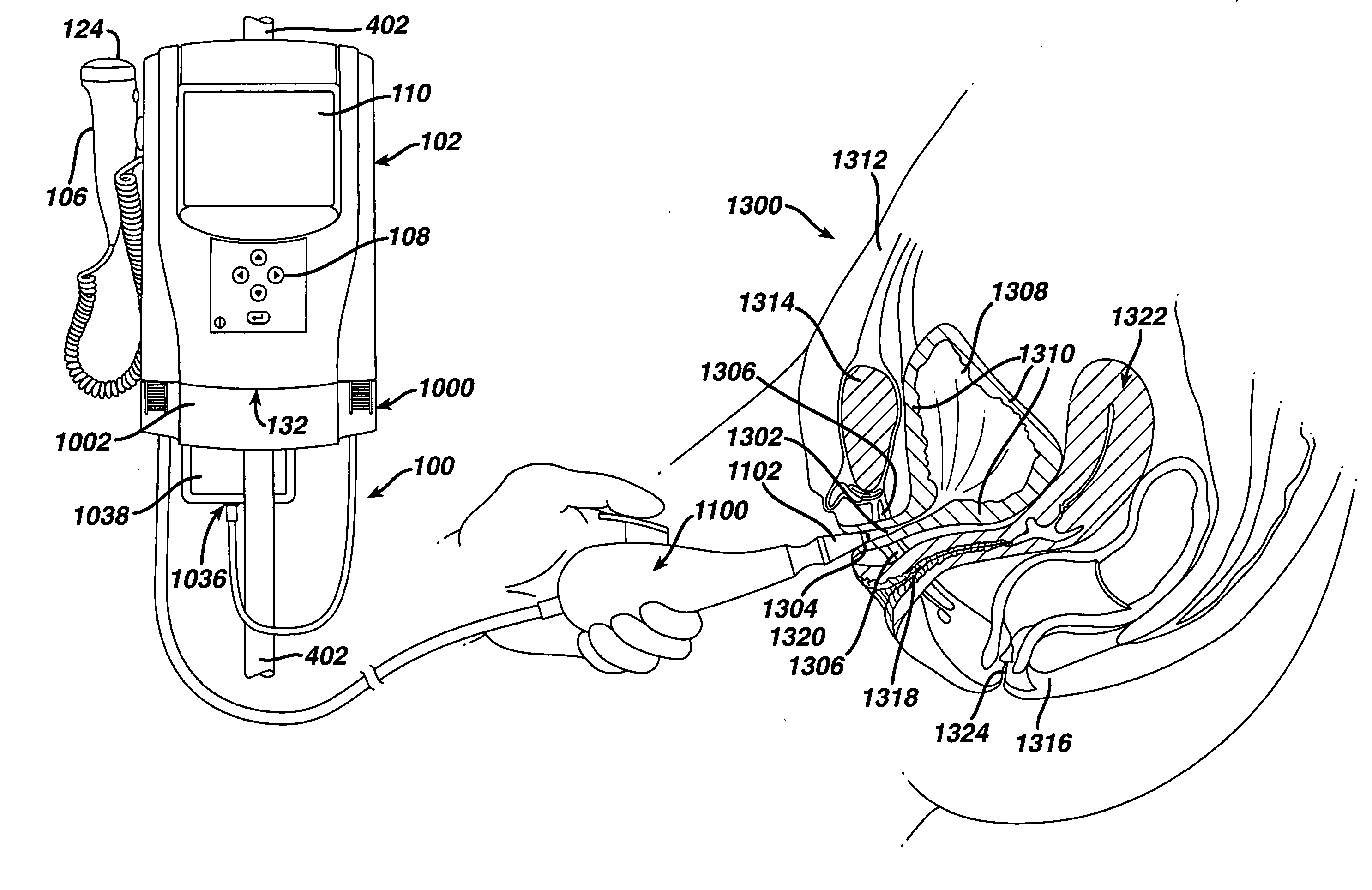 Portable system for assessing urinary function and peforming endometrial ablation