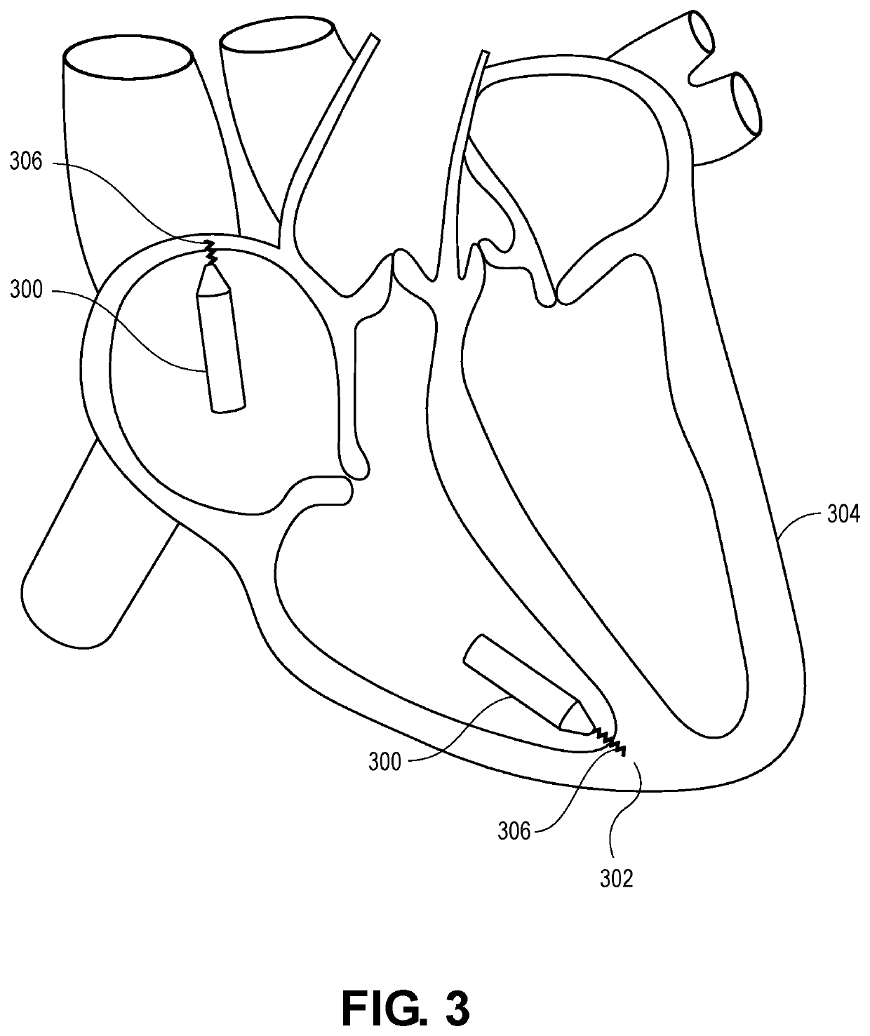 Biostimulator having low-polarization electrode(s)