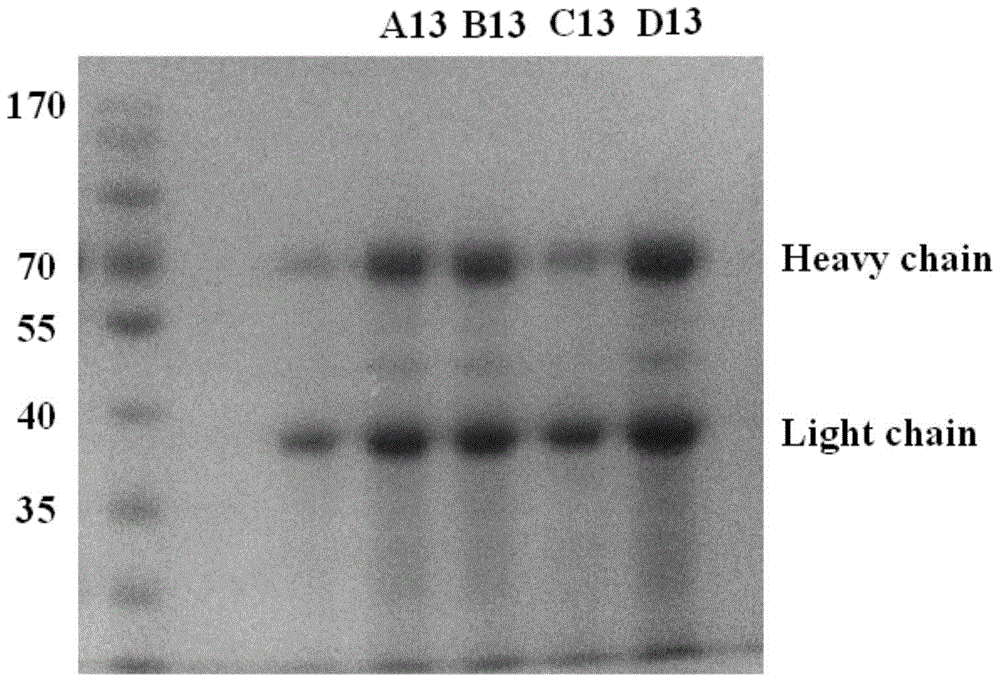 Compound degreasing liquid for extracting chicken egg yolk immunoglobulin and its application