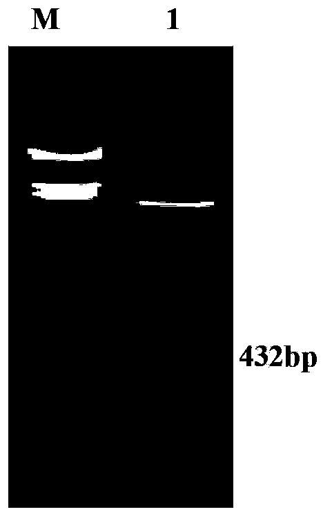 Tuberculosis protein, and preparation and application thereof