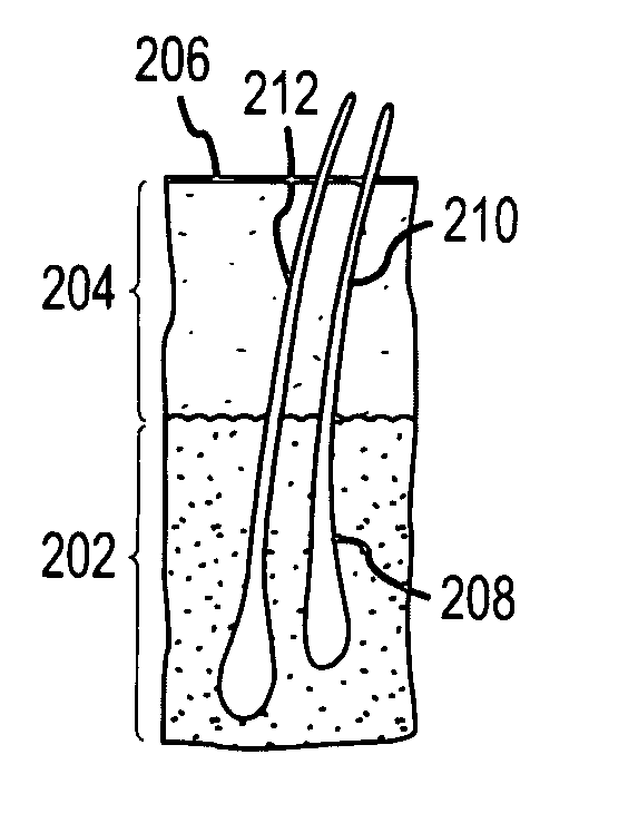 Follicular extraction method and device