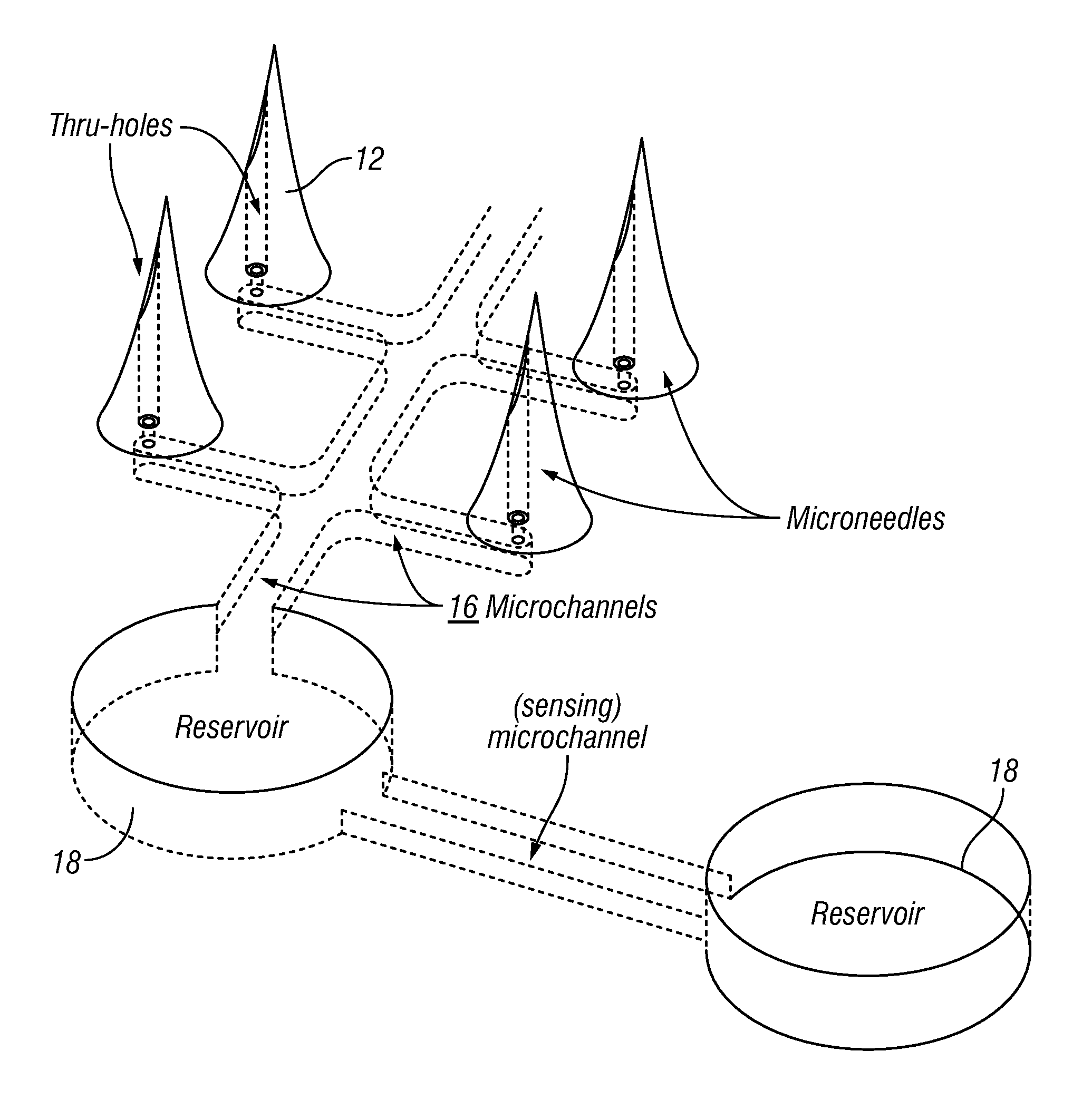 Glucose Monitoring System