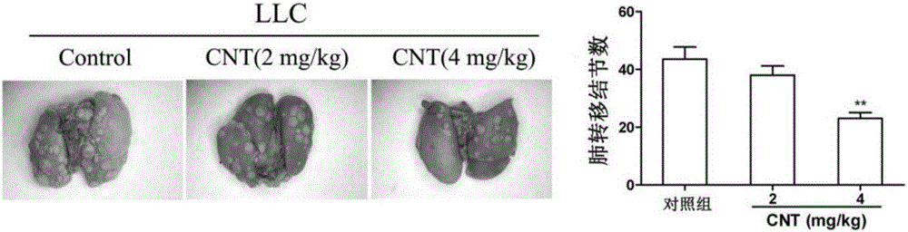 Application of carboxylated multiwalled carbon nanotube to preparation of anti-tumor metastasis medicine