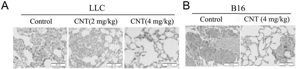 Application of carboxylated multiwalled carbon nanotube to preparation of anti-tumor metastasis medicine