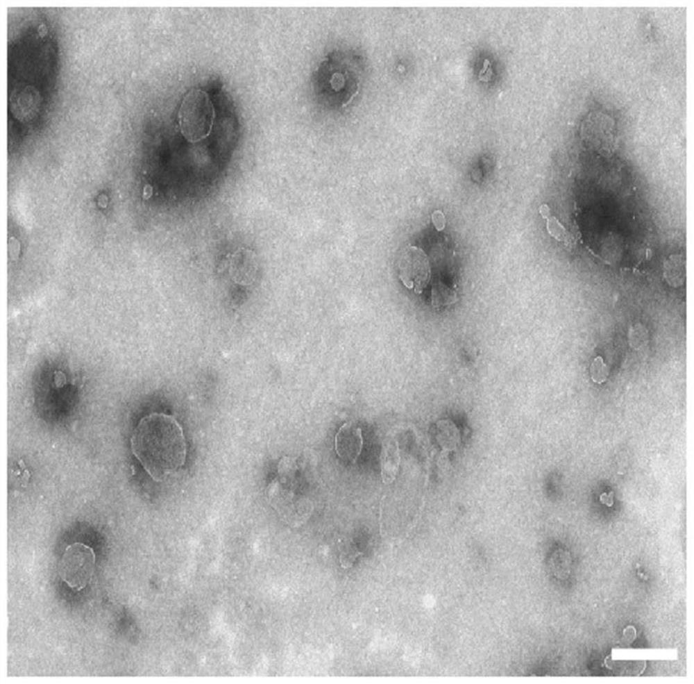 Bacteria-derived outer membrane vesicle vaccine for displaying new antigen, preparation method thereof and application of vaccine in preparation of cancer immunotherapy kit