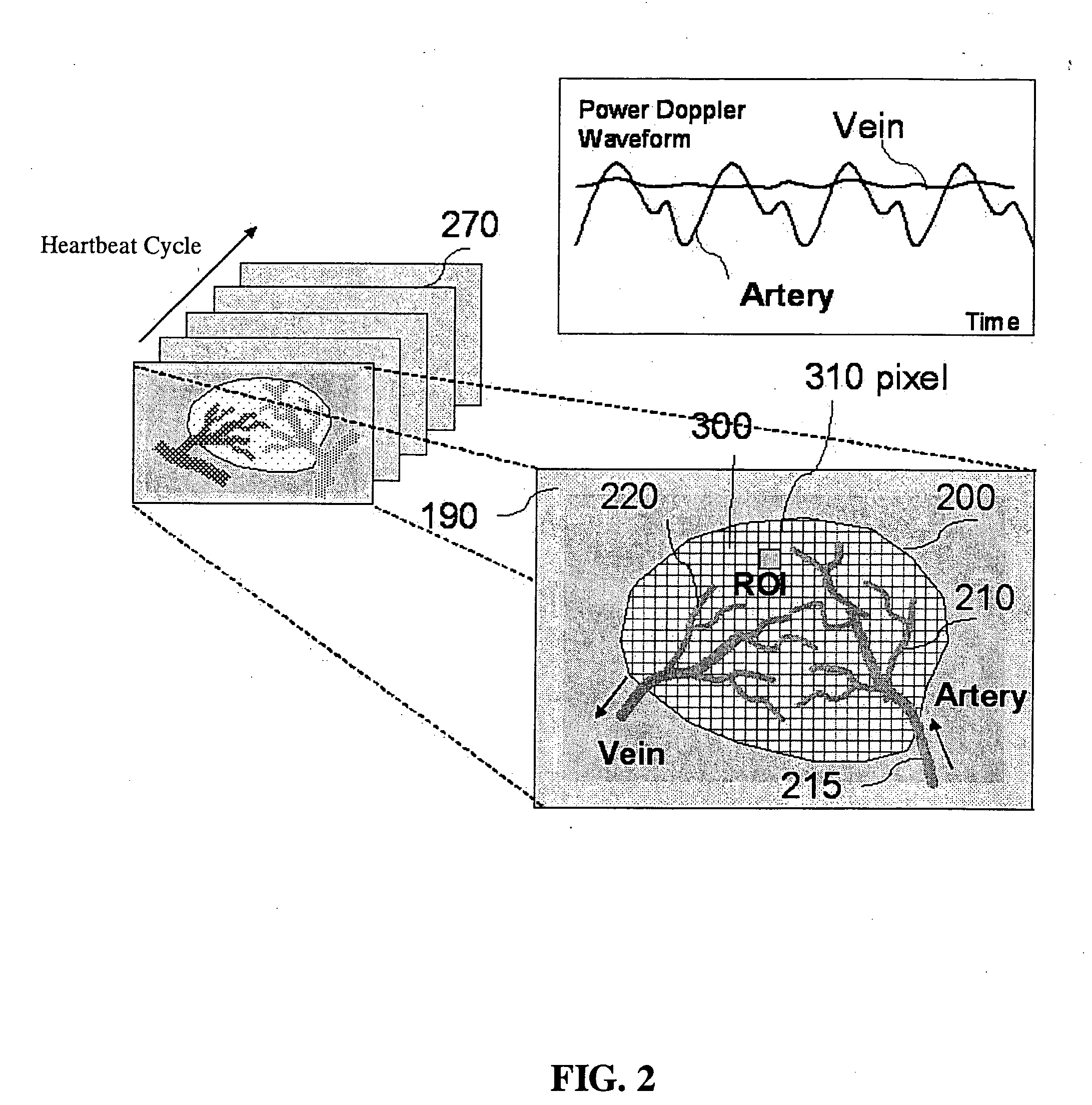 Quantitative non-invasive method for detecting degree of malignancy in tumors and application thereof
