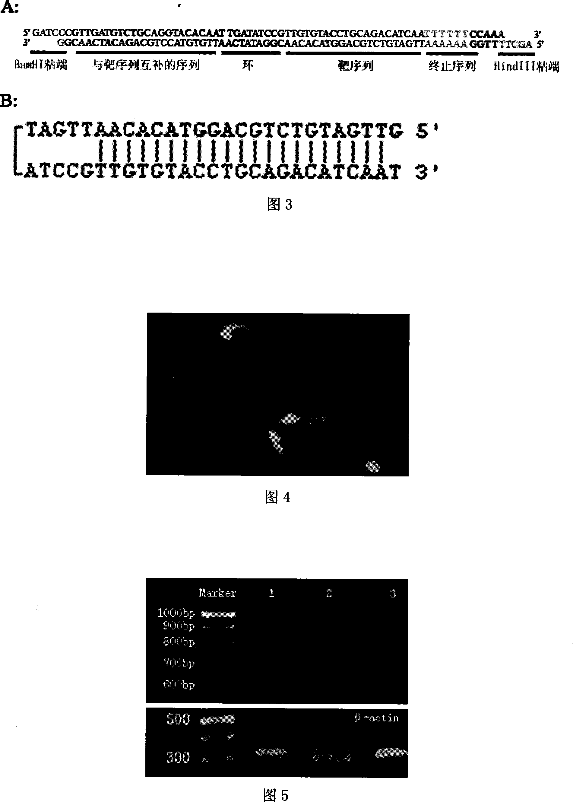 HBV core area resisting siRNA expression template and application
