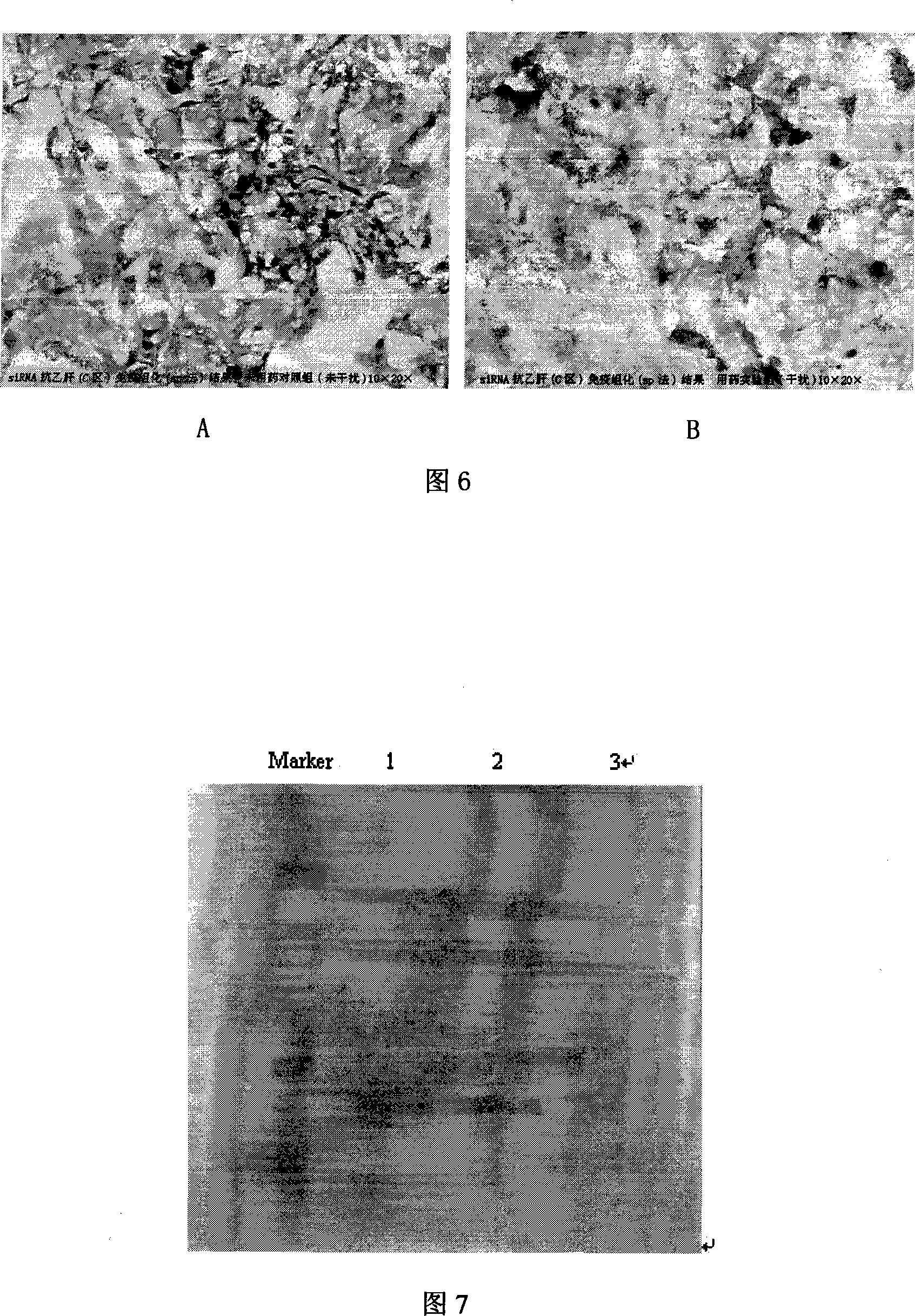 HBV core area resisting siRNA expression template and application