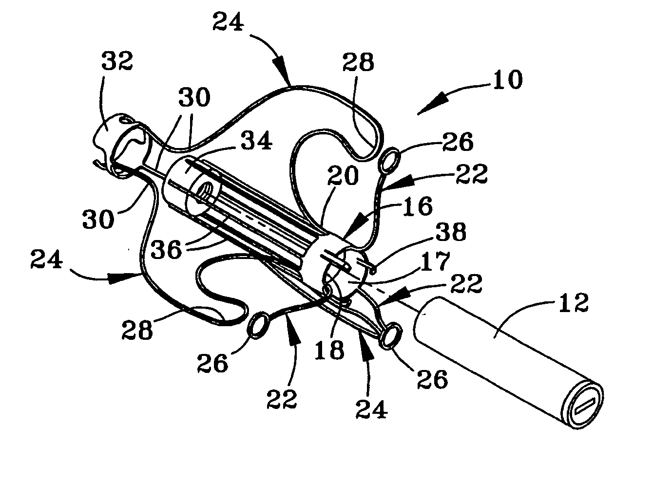 Method and anchor for medical implant placement, and method of anchor manufacture