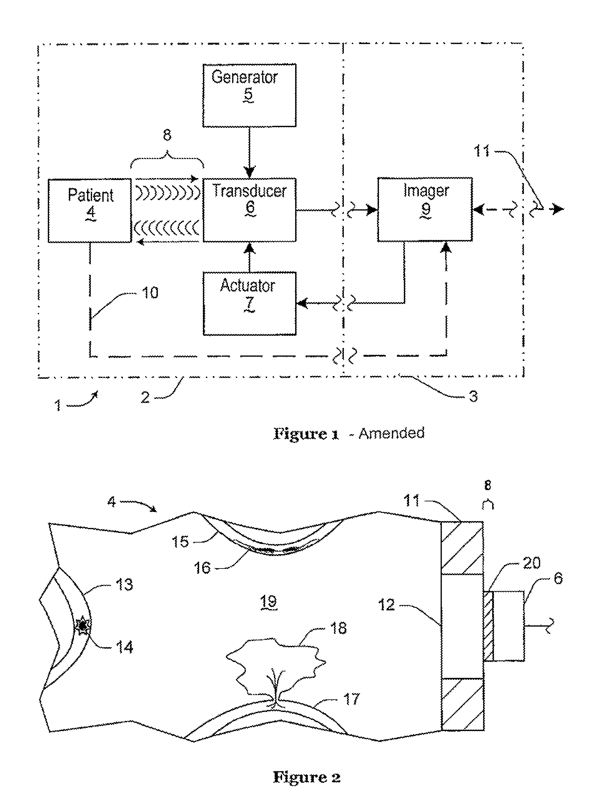 Ultrasonic method, system, and device for diagnosis of stroke
