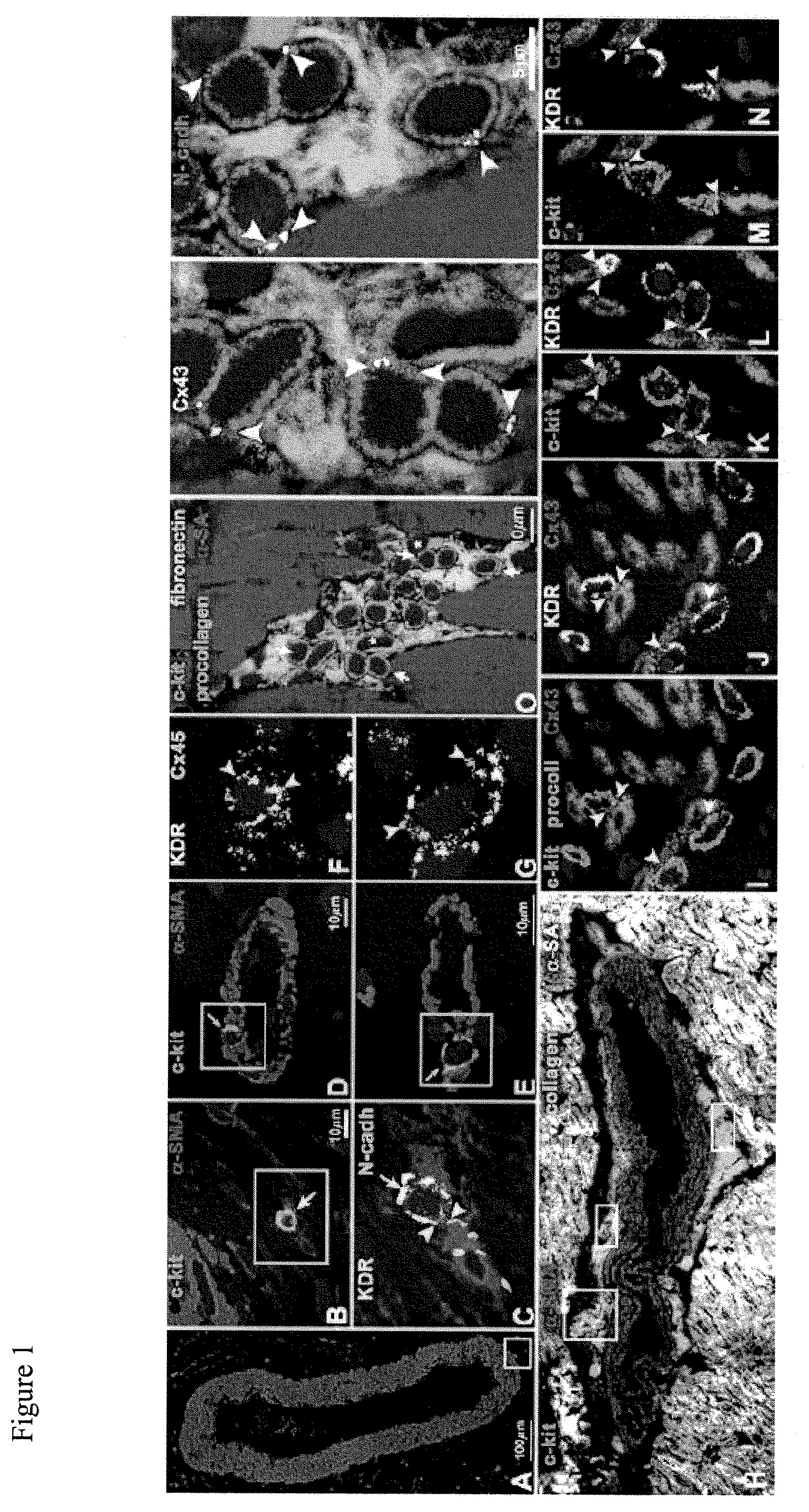 Compositions comprising HDAC inhibitors and methods of their use in restoring stem cell function and preventing heart failure