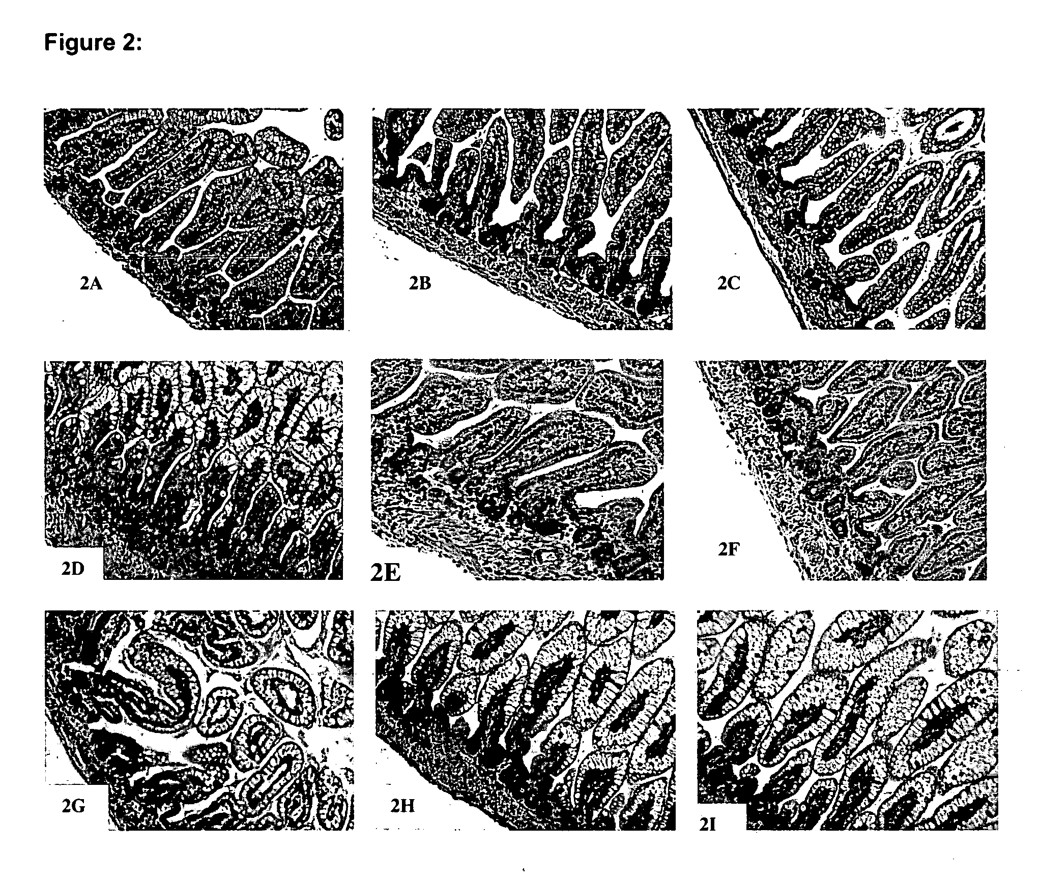 Method for treating or preventing systemic inflammation in formula-fed infants
