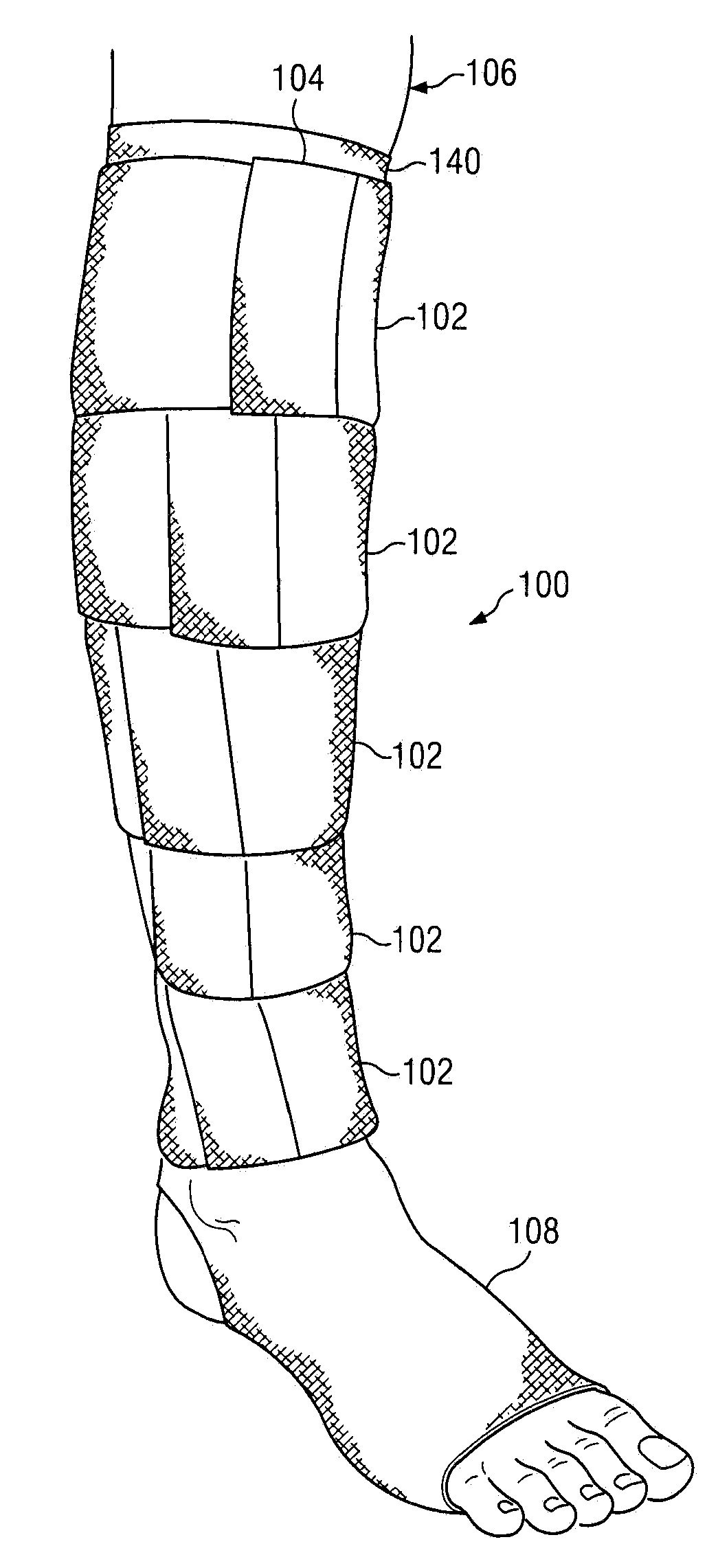 Compression-garment band method