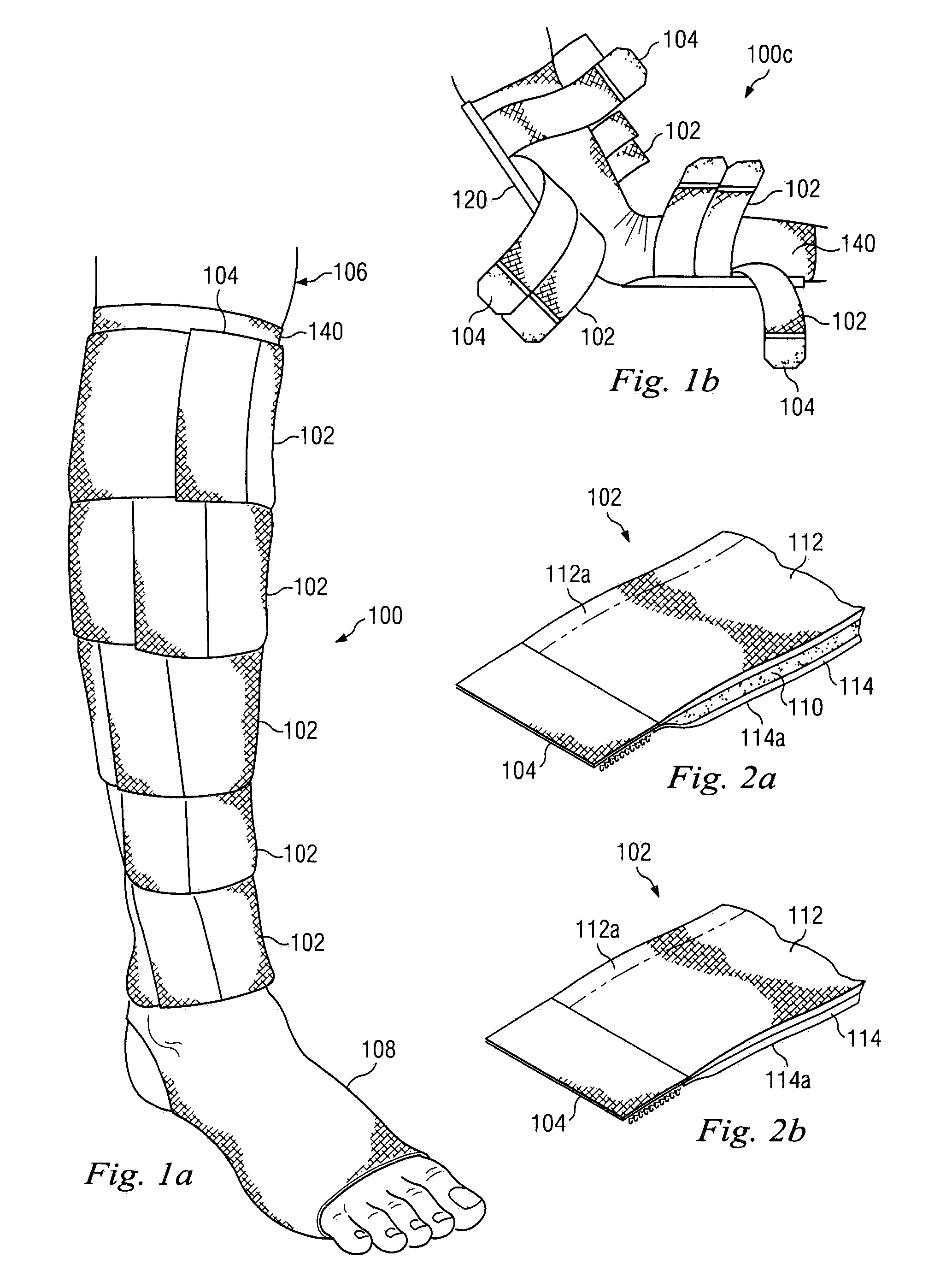 Compression-garment band method