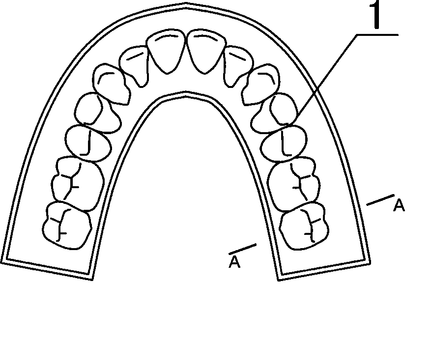 Method for producing macromolecule orthodontic tooth crown