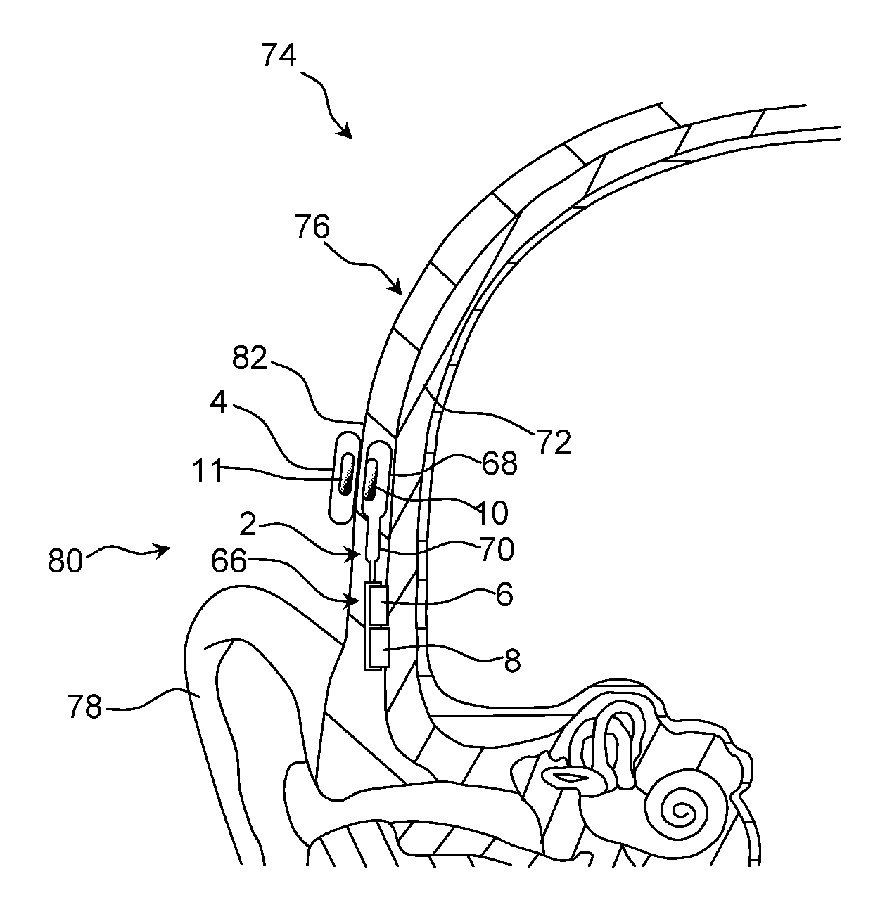 Hearing aid device using dual electromechanical vibrator