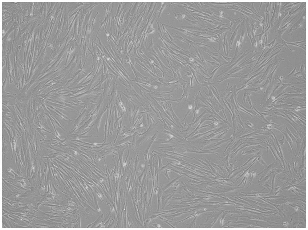 Cryopreservation liquid and cryopreservation method for long-term preservation of stem cells and stem cell products
