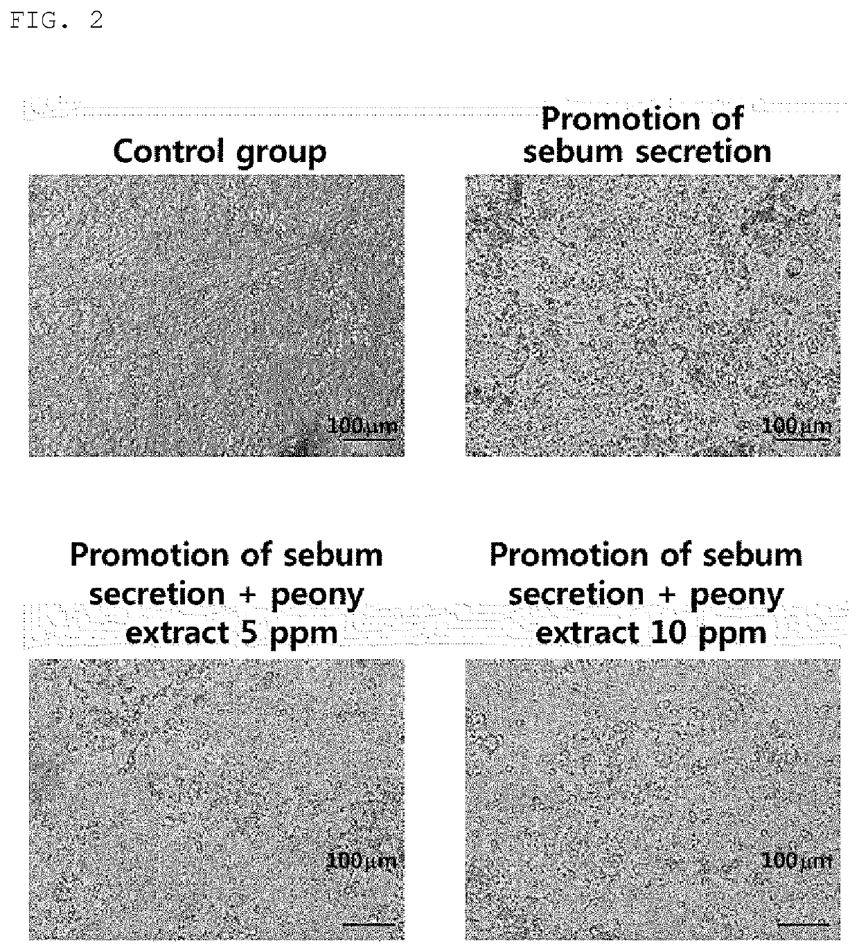 Composition for inhibiting sebum secretion comprising peach sprout extract