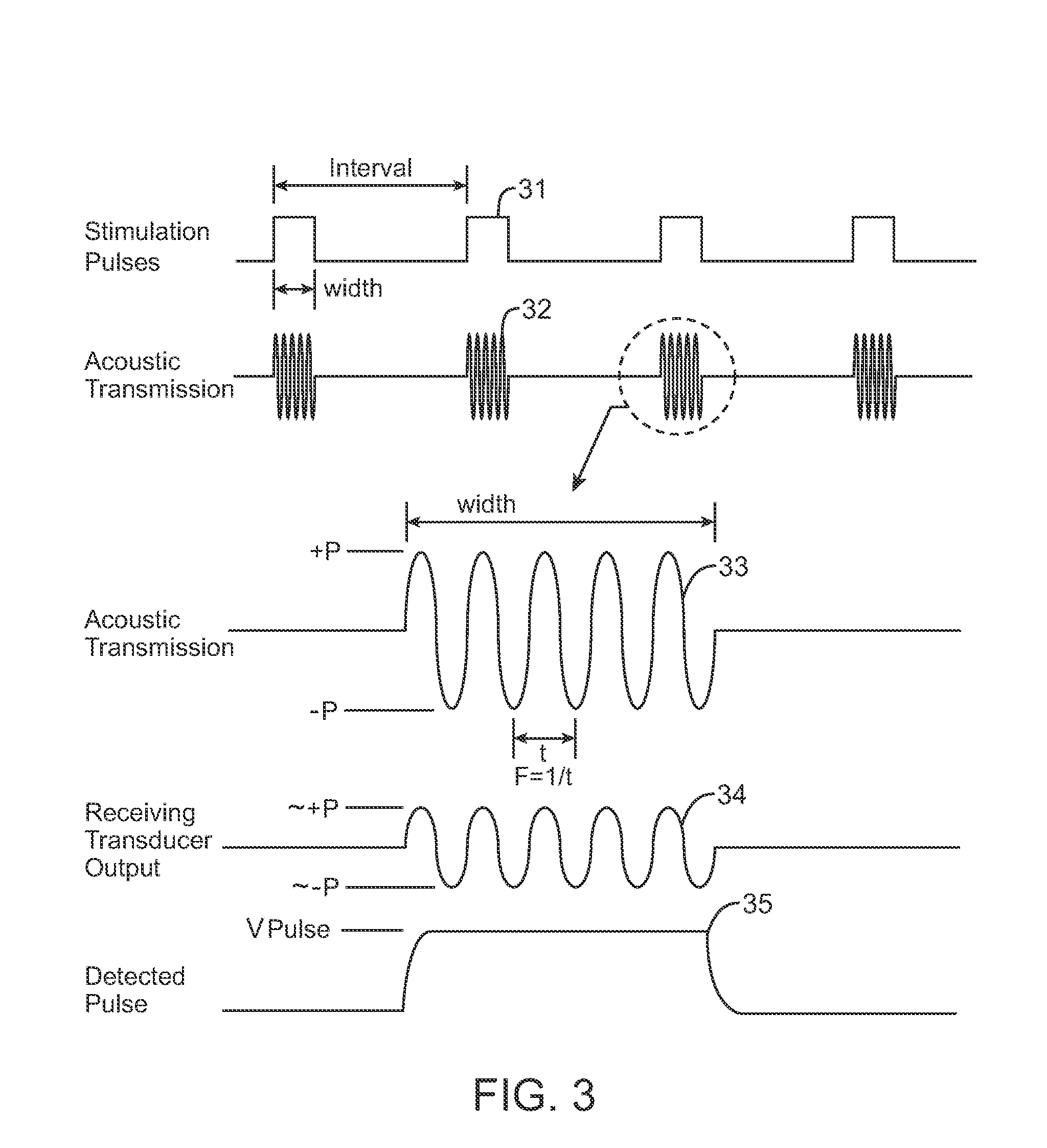 Systems and methods for implantable leadless brain stimulation