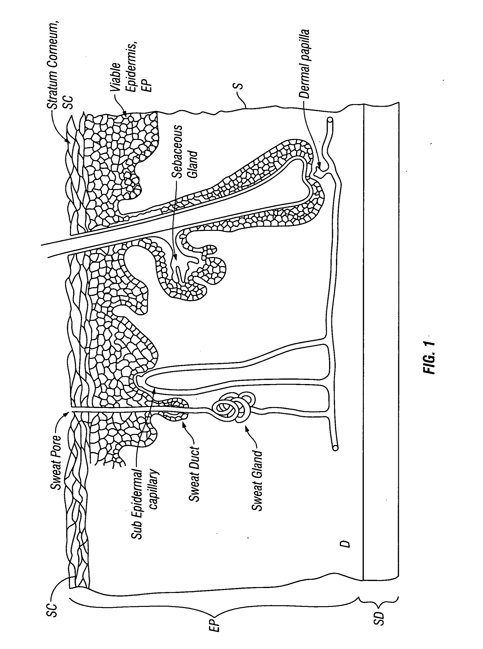 Patches and method for the transdermal delivery of a therapeutically effective amount of iron