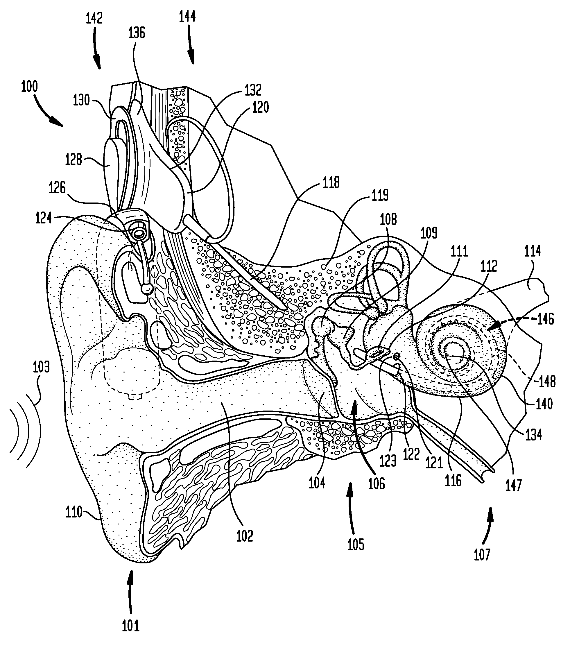 Input selection for an auditory prosthesis