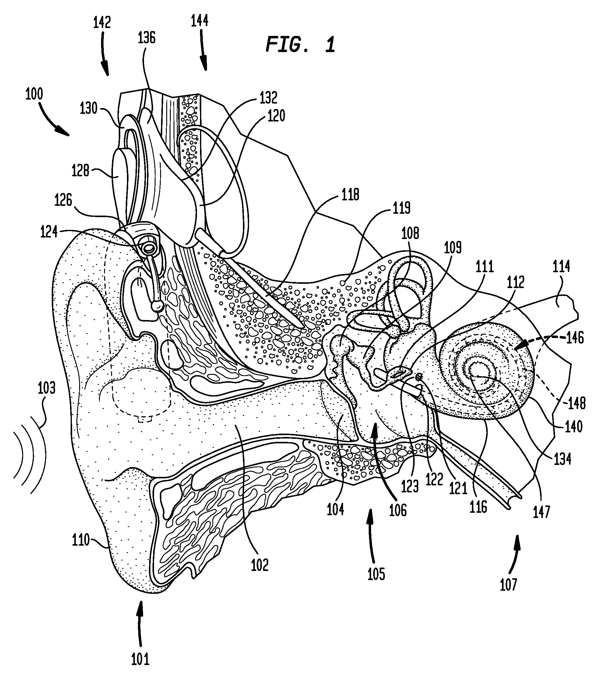 Input selection for an auditory prosthesis